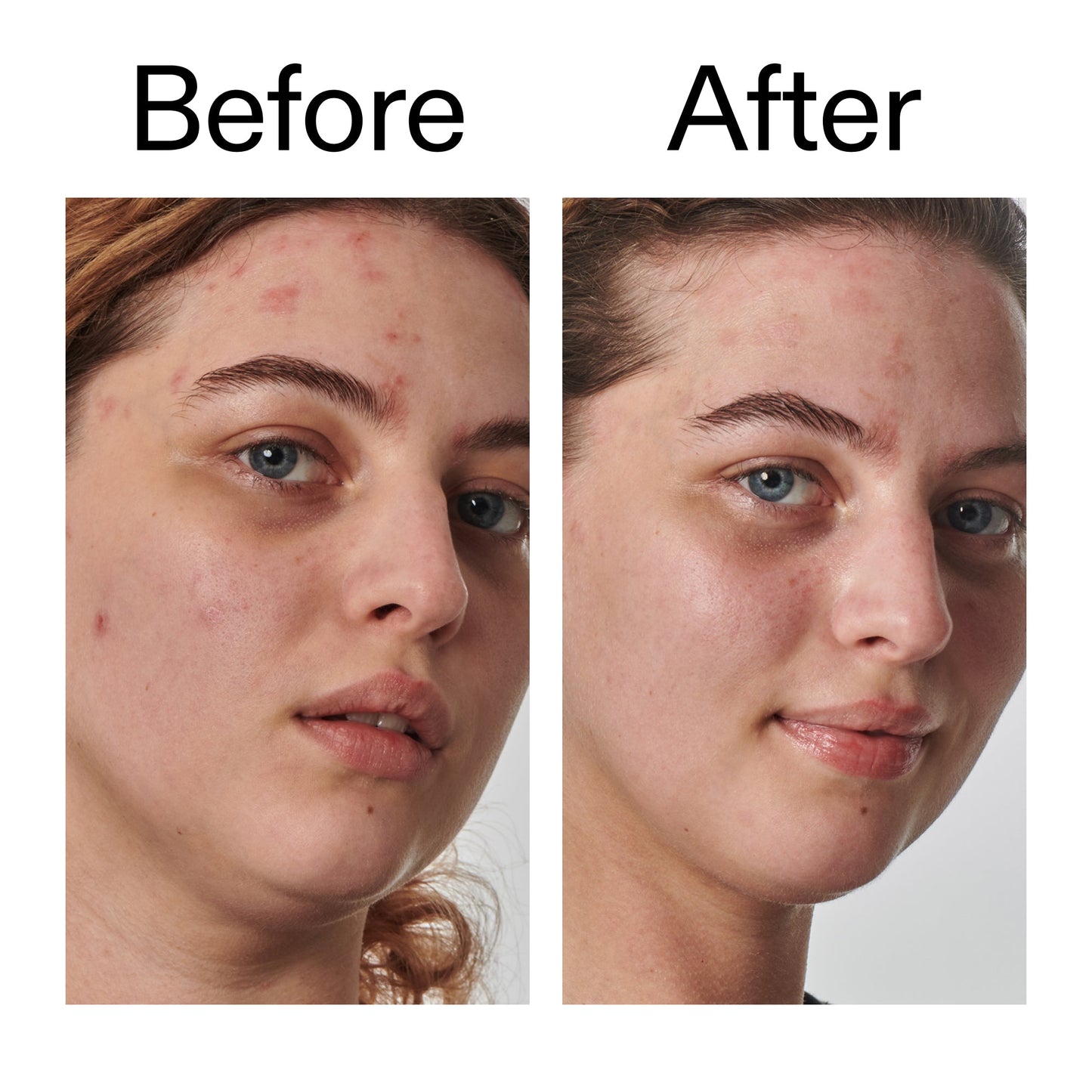 10-urea-moisturizer-w9 Dry_and_Rough_Skin_Solution_Before_After_2000x2000_efa6e639-5c39-49bd-a5dd-f0220293120a.jpg