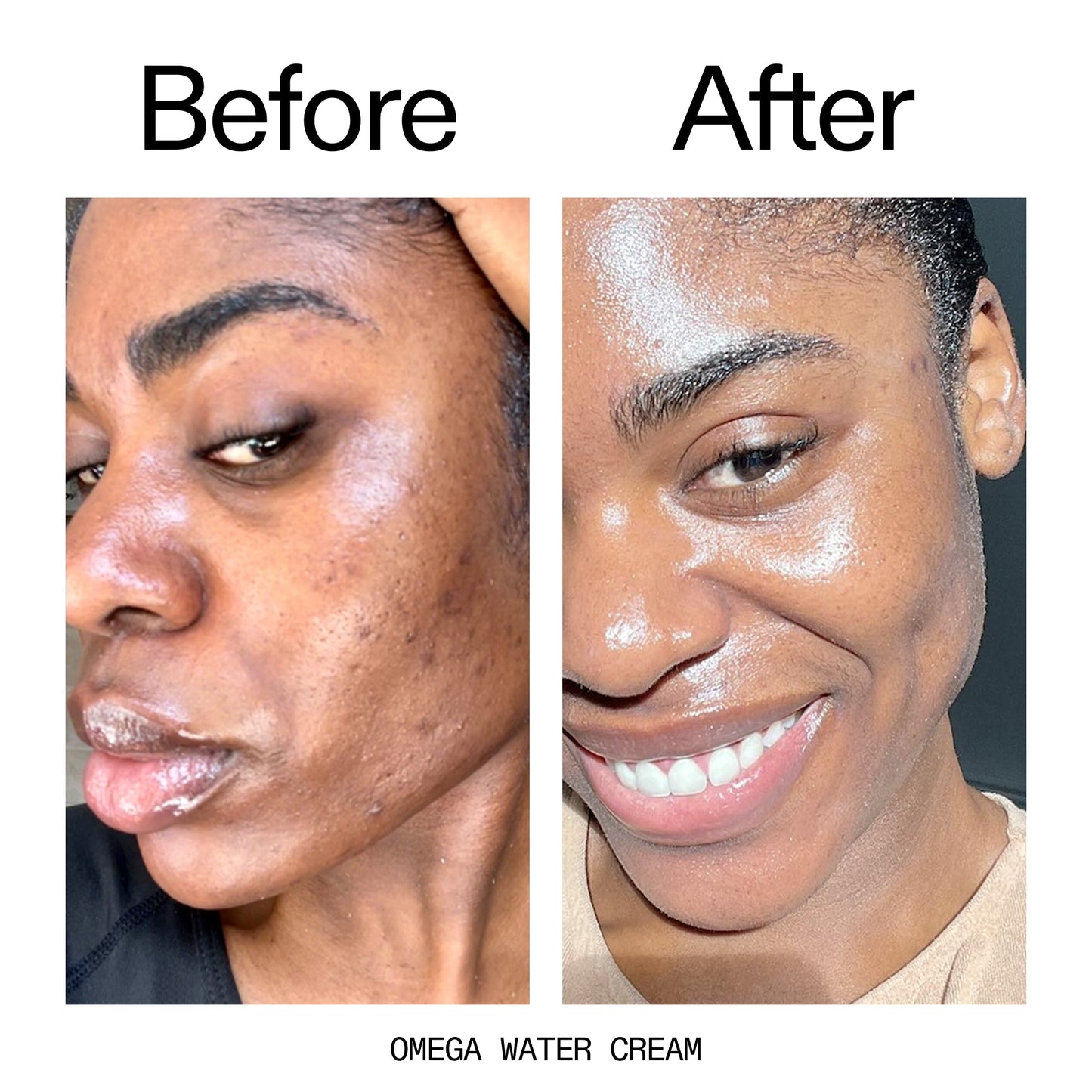 glowing-skin-set-v9 Omega_Water_Cream_Before_After_2000x2000_8e88278b-8c8d-48dc-ac77-4e98ebbd1b77.jpg