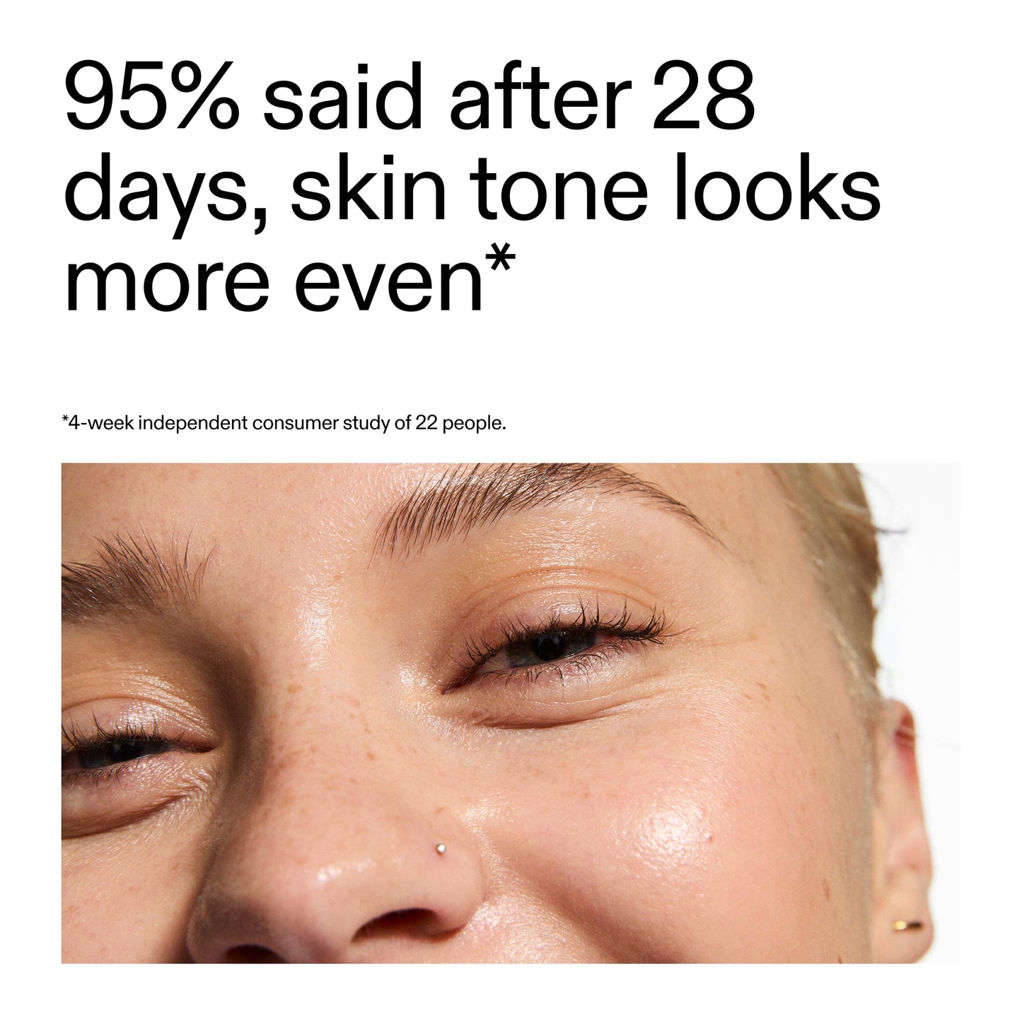 supersize-omega-water-cream-100ml-l2 ROW_Hydrocolloid_Invisible_Pimple_Patches_key_Claims_2000x2000-1.jpg