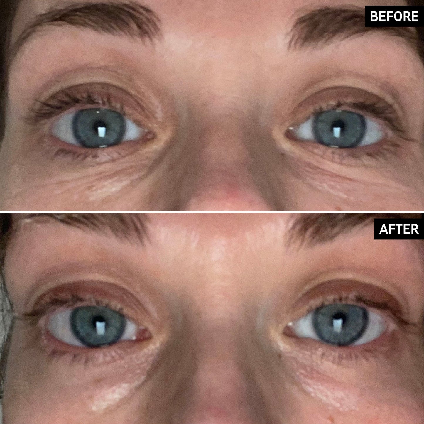 retinol-eye-cream-f8 SITE-UGCBAsApril_Nicole_B_A_PPage_2000x2000_1.jpg