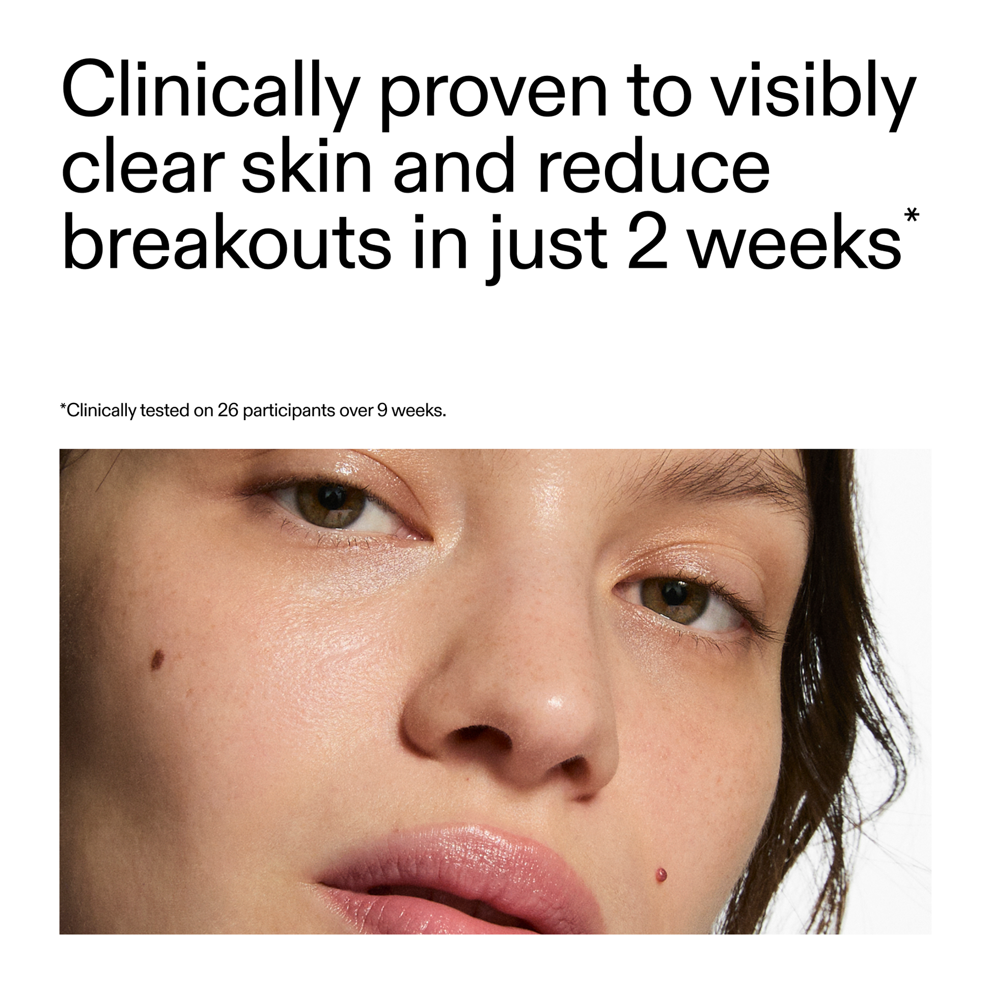360-acne-clearing-serum-z0 360_Serum_Key_Claim.png