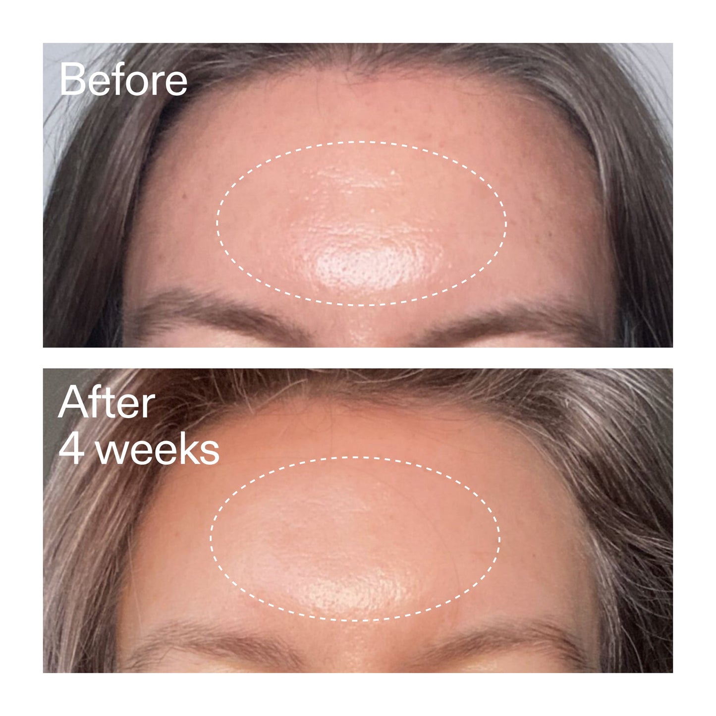 advanced-0-2-retinal-serum-z0 AdvancedRetinal_BeforeAfter1_2000x2000_1da6bb0a-29dd-41d1-95b7-8679696bbf0f.jpg