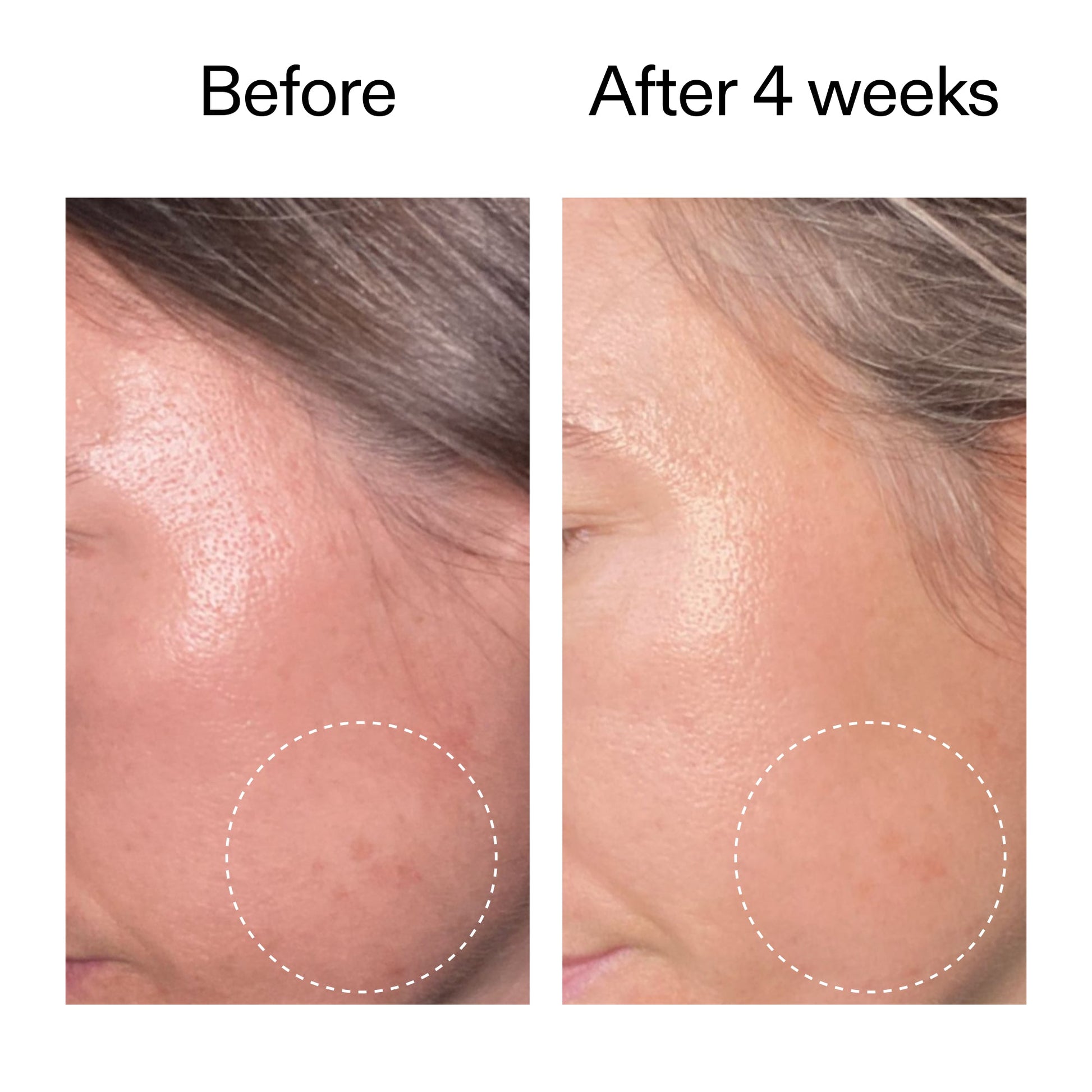 advanced-0-2-retinal-serum-z0 AdvancedRetinal_BeforeAfter2__2000x2000_62fb16bb-77ae-4d63-8500-88dbf847f4b9.jpg
