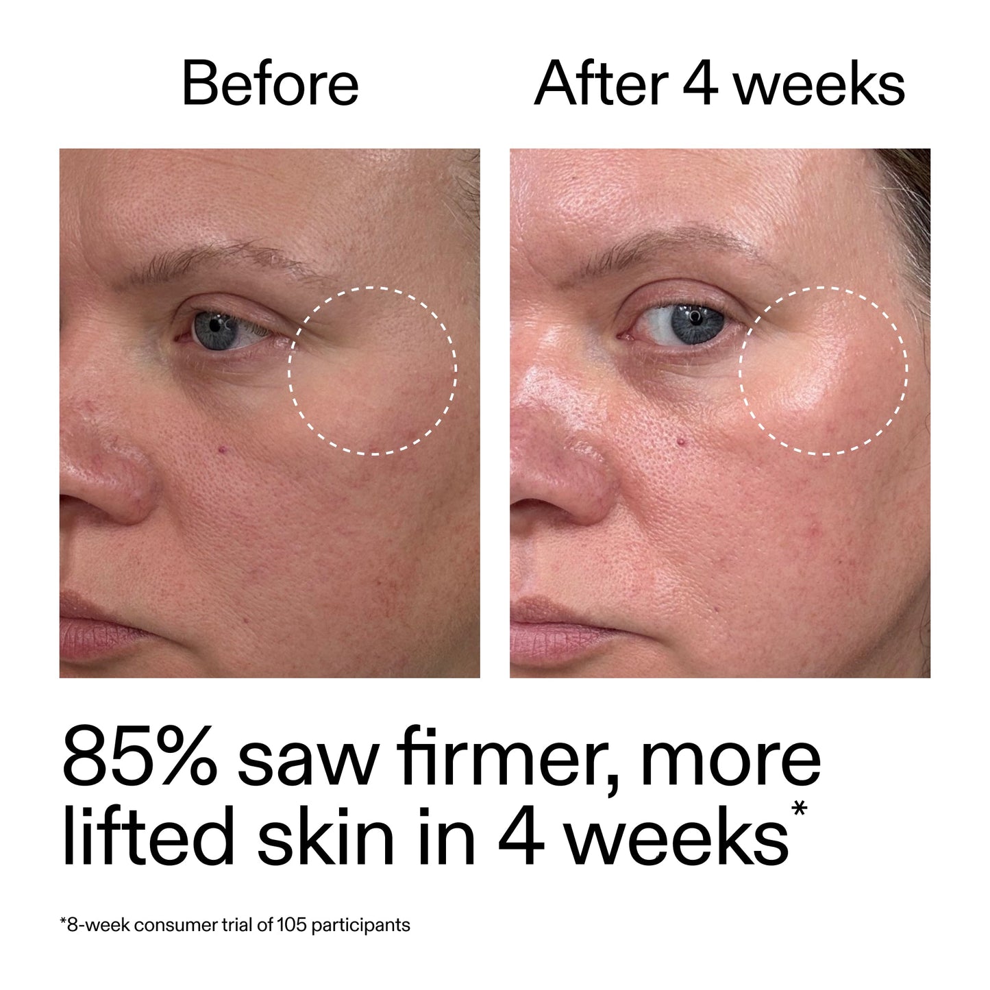 advanced-0-2-retinal-serum-z0 AdvancedRetinal_BeforeAfter_Claim1_2000x2000_bcc385c4-5e73-4f1e-aba8-64267937d0d3.jpg