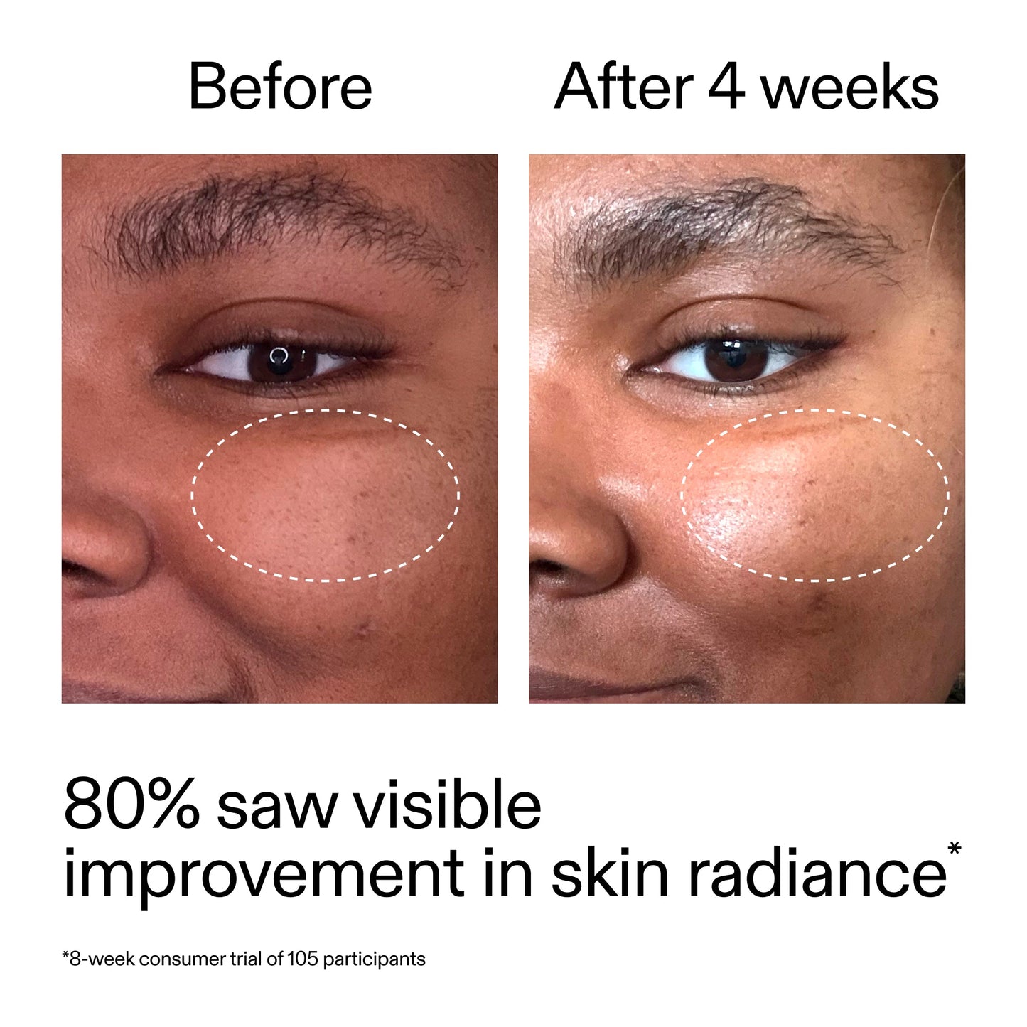 advanced-0-2-retinal-serum-z0 AdvancedRetinal_BeforeAfter_Claim2_2000x2000_39d11e3d-eda9-44ec-ab32-2903b1a368bd.jpg