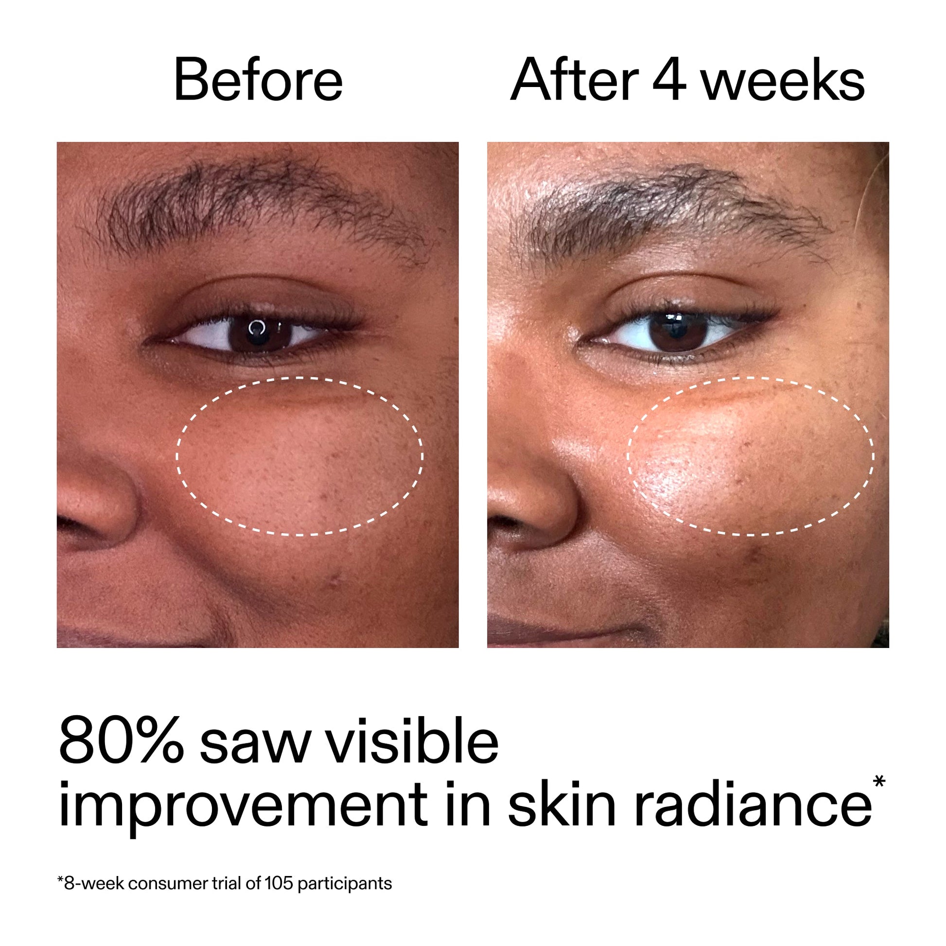advanced-0-2-retinal-serum-z0 AdvancedRetinal_BeforeAfter_Claim2_2000x2000_39d11e3d-eda9-44ec-ab32-2903b1a368bd.jpg