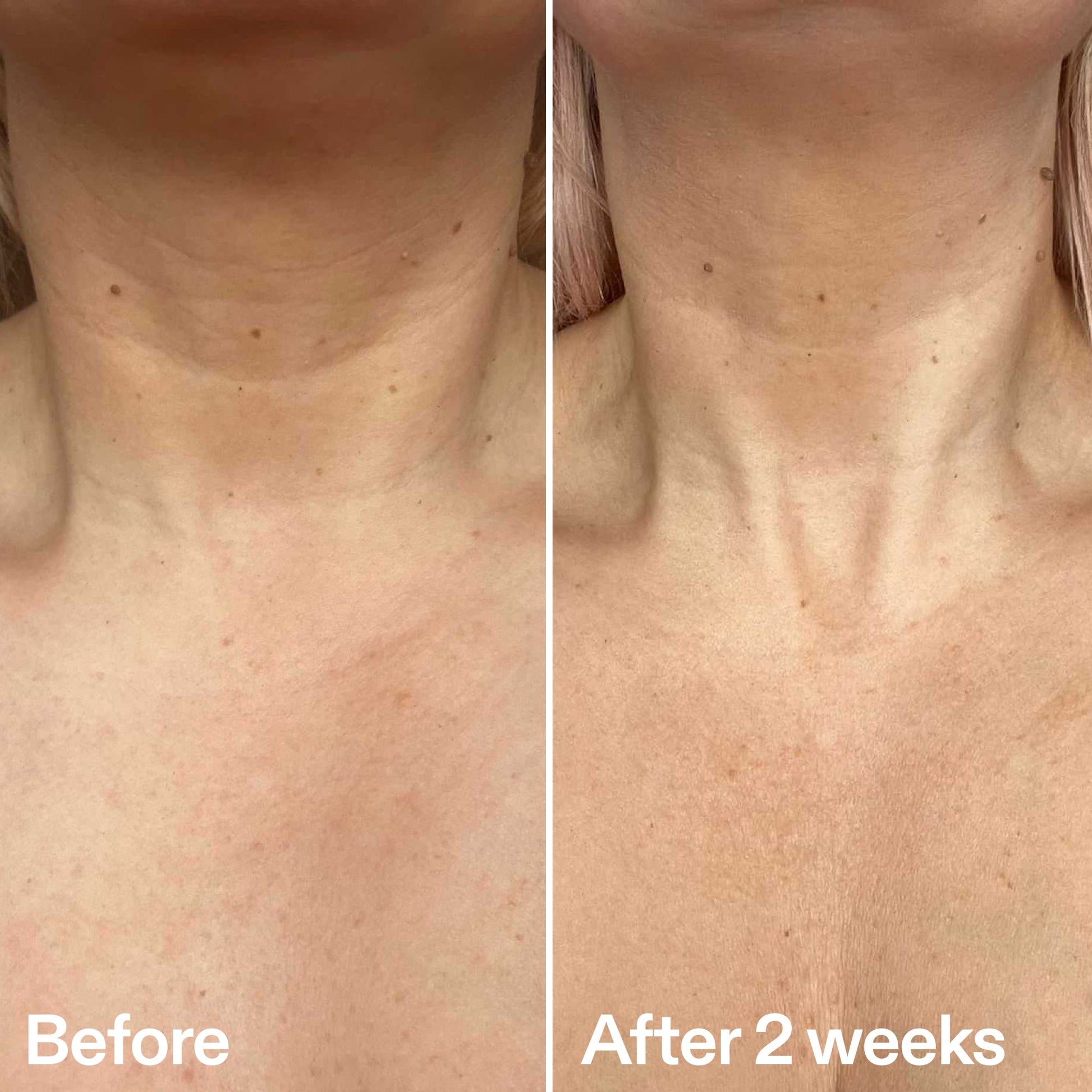 bio-active-neck-lift-stick-f5 B_A_2.jpg
