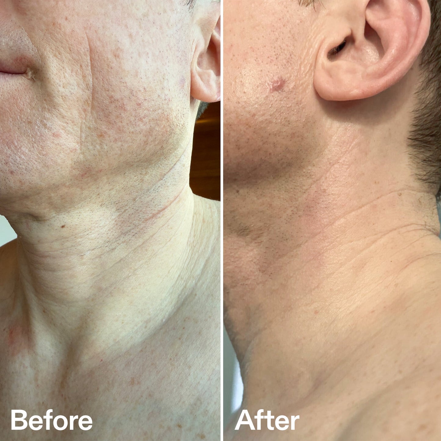 bio-active-neck-lift-stick-f5 B_A_afa2743e-b8e2-4504-92f4-e281cb6cf759.jpg
