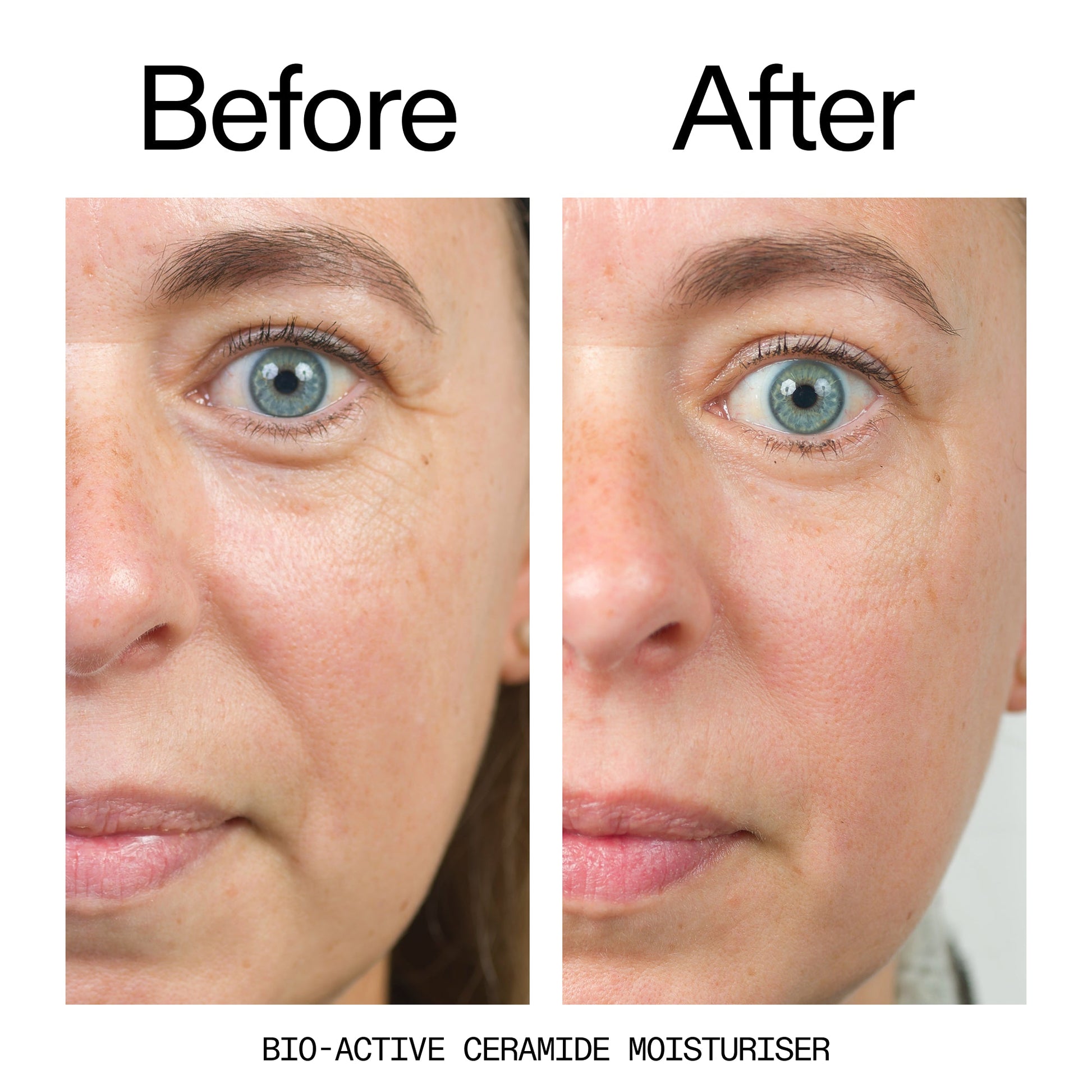 barrier-boosting-trio-x9 Bio-Active_Before_After_2000x2000_600947b4-e8c5-425a-9155-fc15bc83aa12.jpg