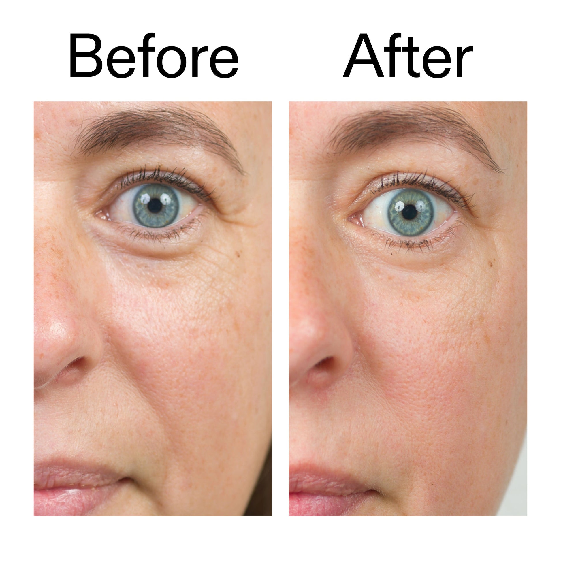bio-active-ceramide-moisturizer-l4 Bio-Active_Before_After_2000x2000_566e5a9e-135e-417a-8242-b44e5fa35463.jpg