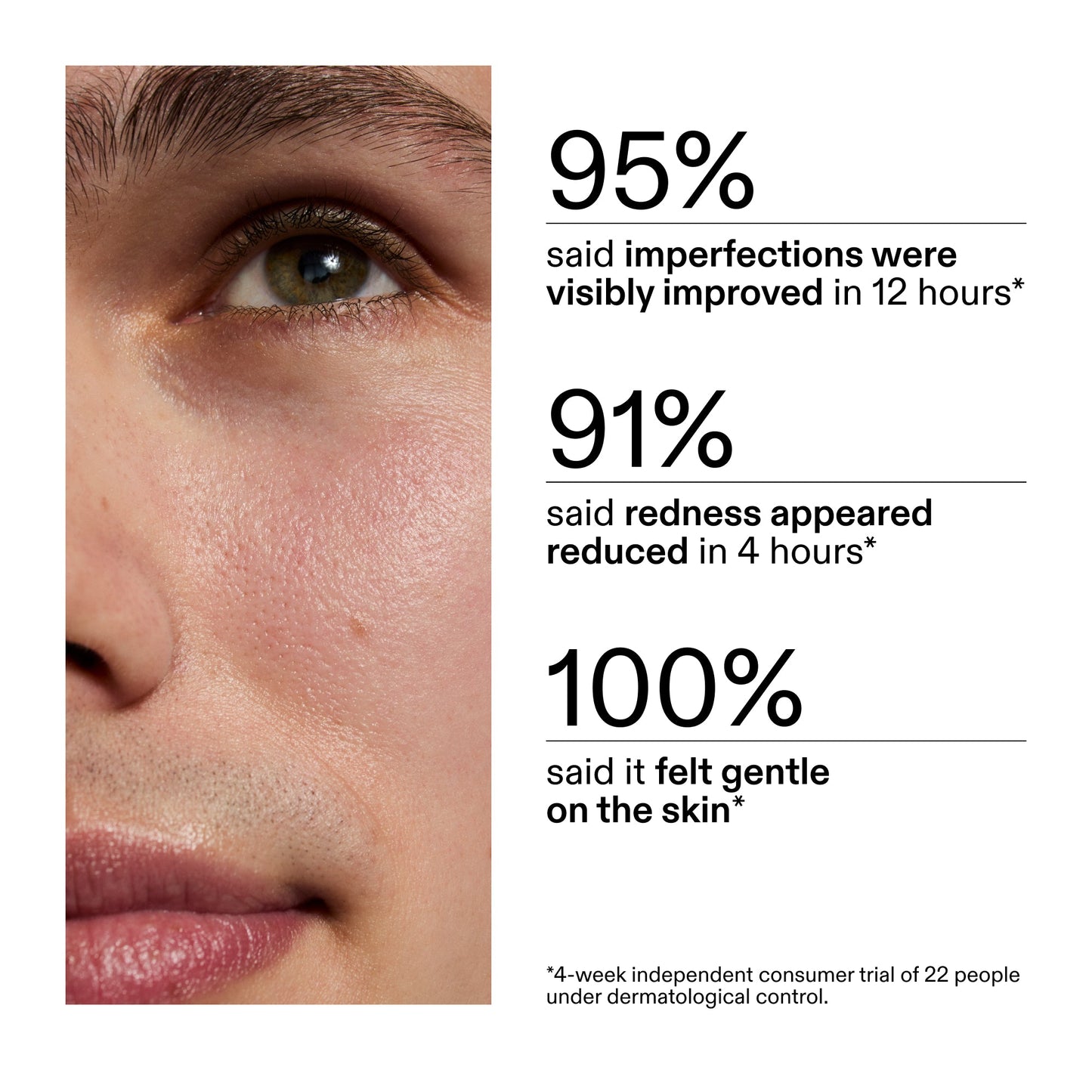 succinic-acid-acne-treatment-q6 CA_Succinic_Acid_Treatment_key_Claims_2000x2000_db91b0f1-7f29-4bfe-bb16-63a47f500960.jpg