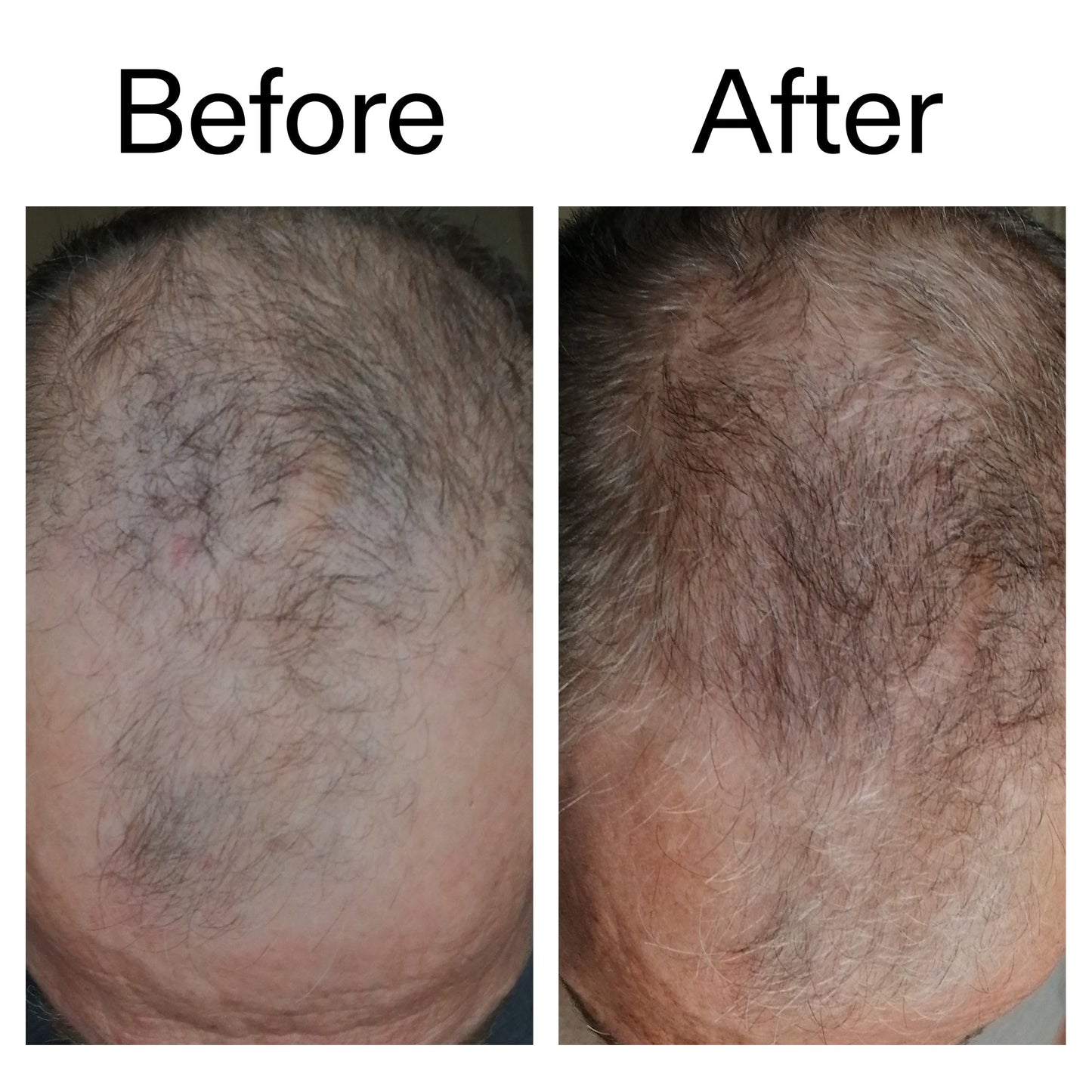 caffeine-stimulating-scalp-treatment-g0 Caffeine_Scalp_Treatment_B_A_Ppage_2000_x_2000.jpg