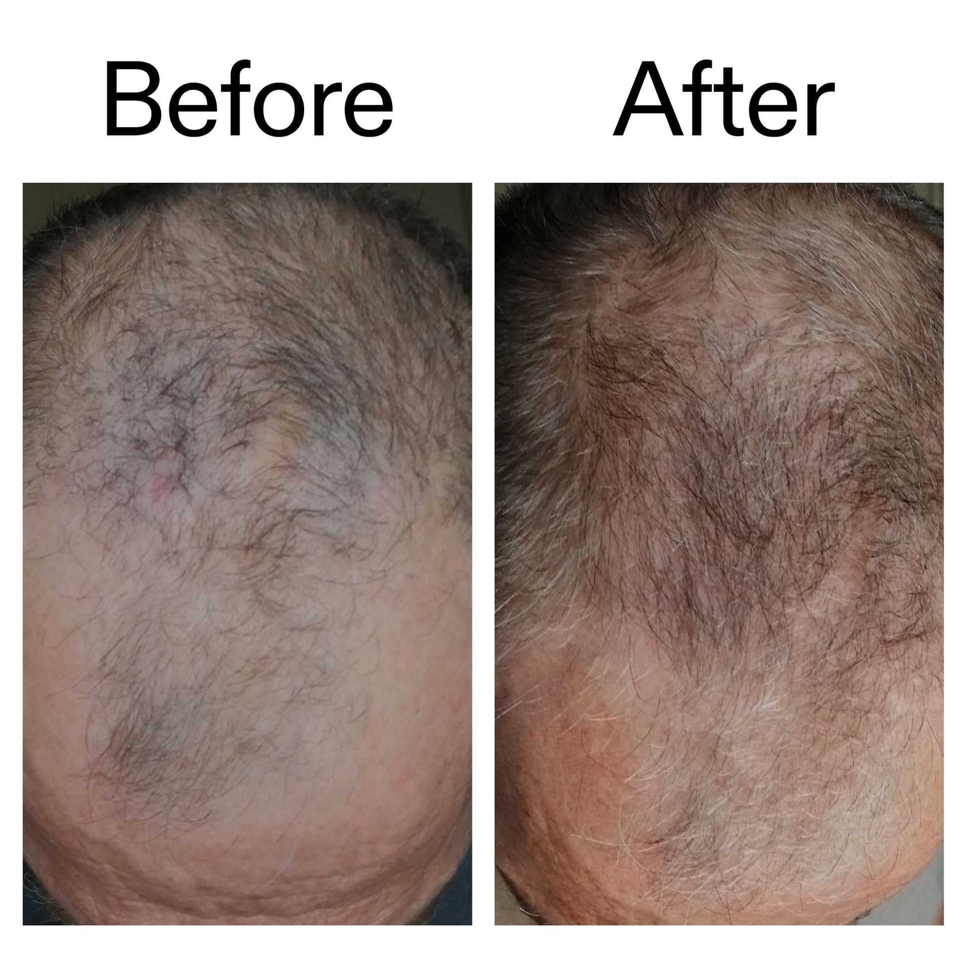 caffeine-stimulating-scalp-treatment-g0 Caffeine_Scalp_Treatment_B_A_Ppage_2000_x_2000.jpg