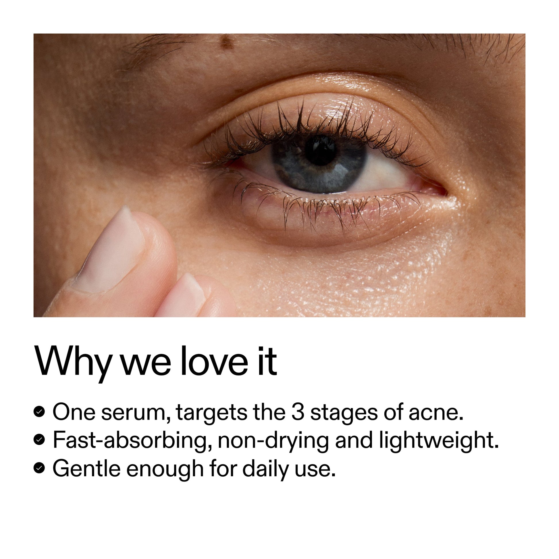 360-acne-clearing-serum-z0 Dioic_Whyweloveit_2000x2000_175aafd3-0cbe-403a-b317-a8362881bfe2.jpg