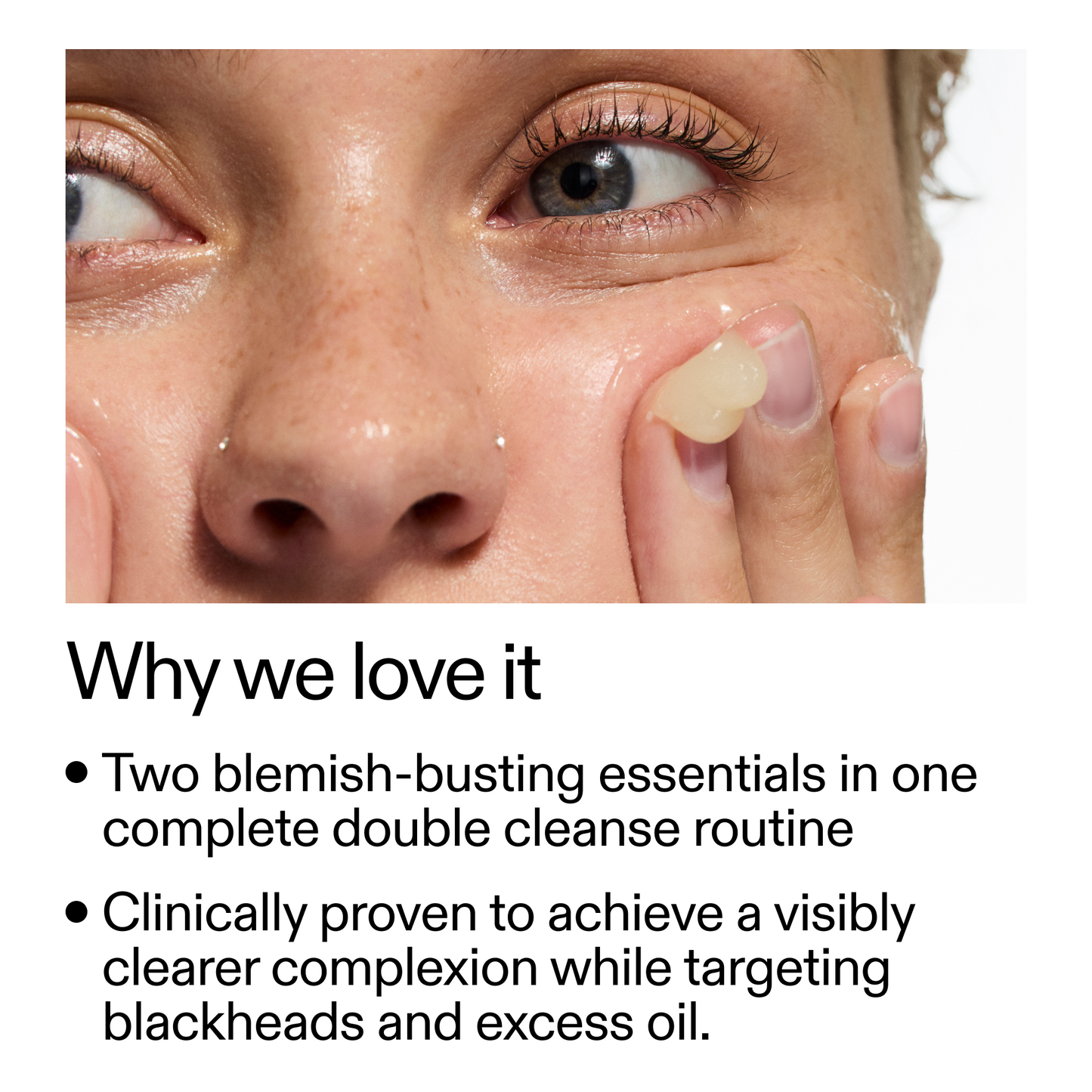 acne-double-cleanse-duo-n8 Double_Cleanse_Duo_for_Breakouts_Why_We_2000x2000_f242cb12-bb5c-487c-b203-071ccb406ec5.png