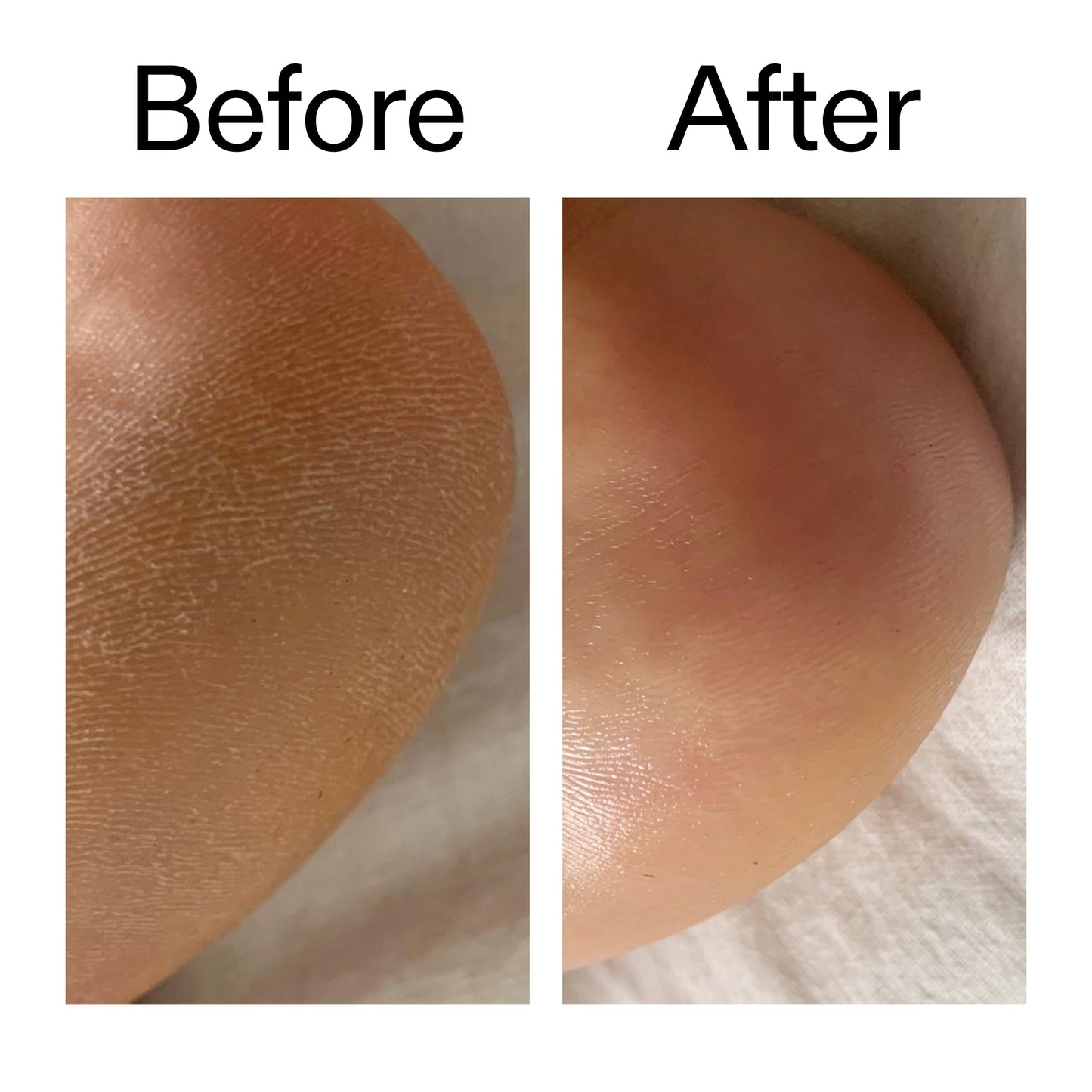 glycolic-acid-exfoliating-body-stick-k6 Glycolic_Acid_Exfoliating_Body_Stick_Before_After_V1_2000x2000_a3043625-9400-429a-a7fb-d6dbd220f722.jpg