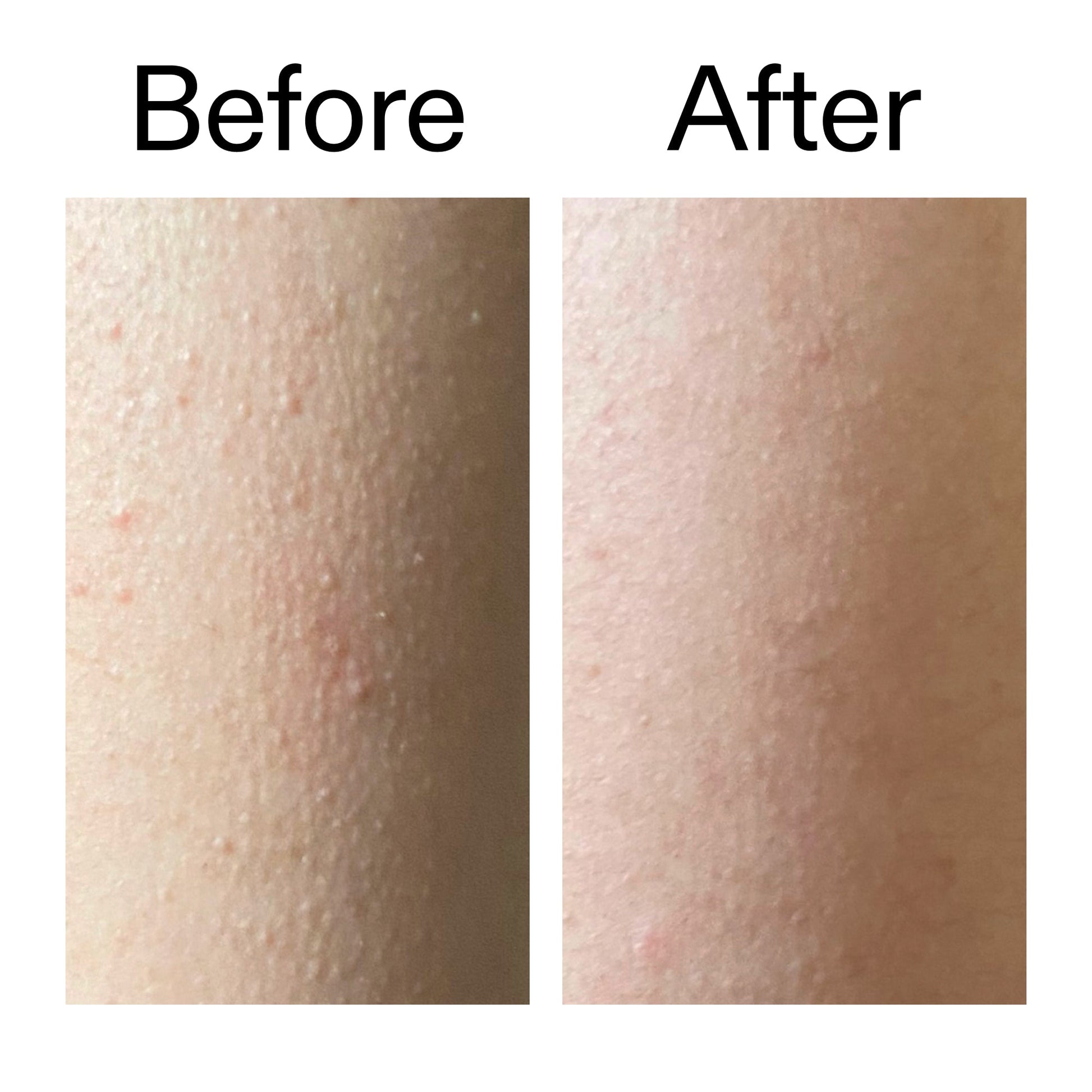 glycolic-acid-exfoliating-body-stick-k6 Glycolic_Acid_Exfoliating_Body_Stick_Before_After_V2_2000x2000_2e4ba052-94f6-4d56-82df-7bdb5b2df7ae.jpg
