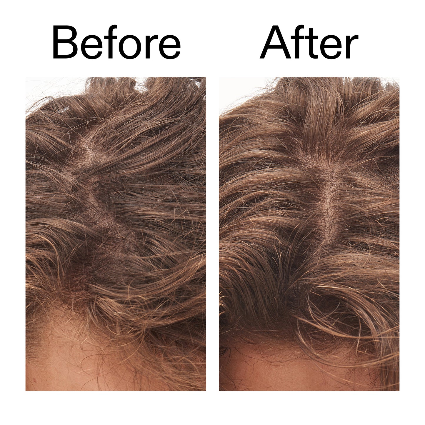 glycolic-acid-exfoliating-scalp-scrub-x4 Glycolic_Acid_Exfoliating_Scalp_Scrub_Before_After_2000x2000_b8561c87-05a1-4caa-80f7-1b6b33d750f7.jpg