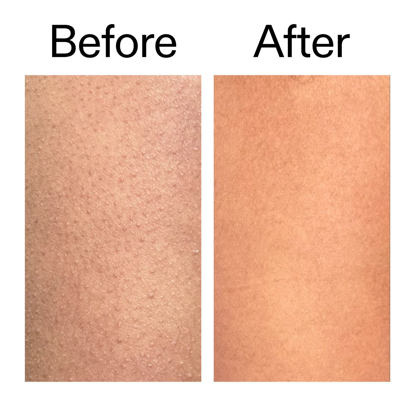 glycolic-acid-exfoliating-body-stick-k6 Glycolic_Body_Stick_B_A_2000x2000_6e6e6b4d-5bd7-43c0-aeed-4d66788e8995.jpg