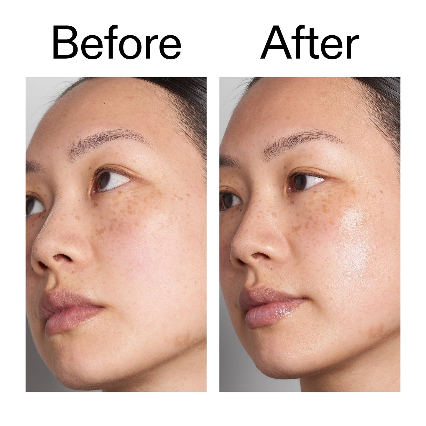supersize-hyaluronic-acid-serum-100ml-f2 Hyaluronic_Acid_Before_After_2000x2000_d7983956-8aa2-4ea3-8255-c63e8d4f892e.jpg
