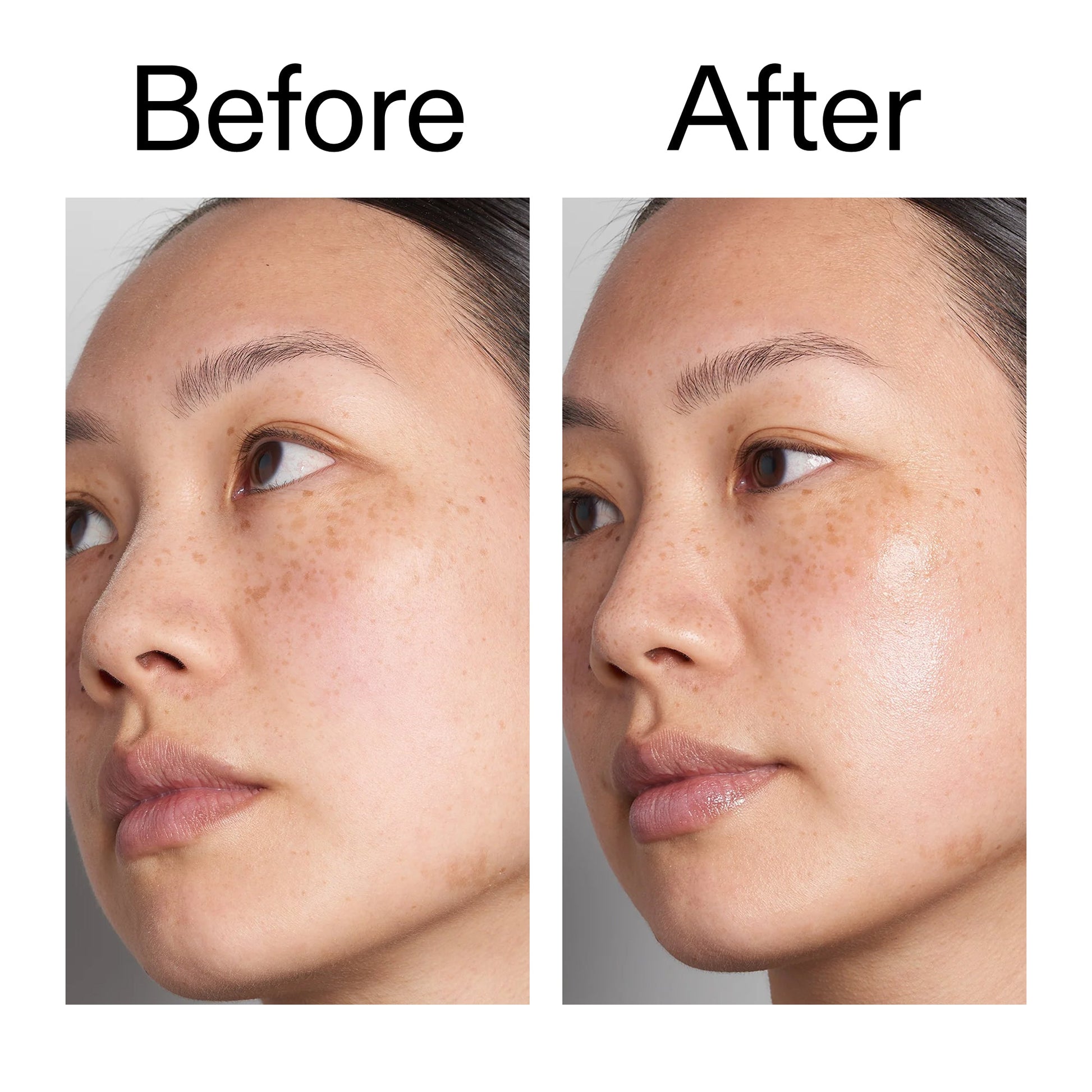 supersize-hyaluronic-acid-serum-100ml-duo-s3 Hyaluronic_Acid_Before_After_2000x2000_d7983956-8aa2-4ea3-8255-c63e8d4f892e.jpg