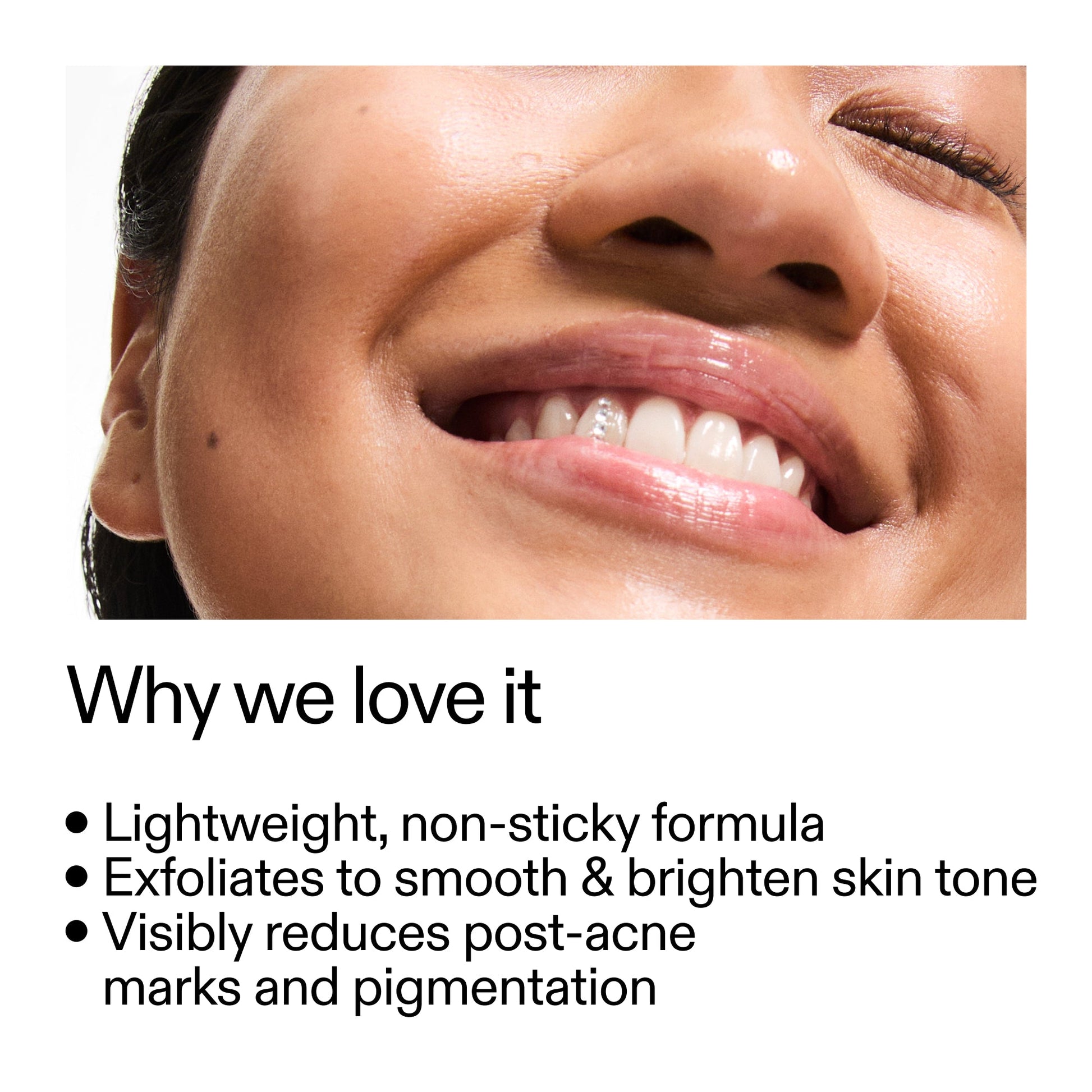 mandelic-acid-treatment-w2 Mandelic_Acid_Treatment_Why_we_love_it_2000x2000_6dfe29a9-2a79-464f-a5e8-e5ac37d93388.jpg