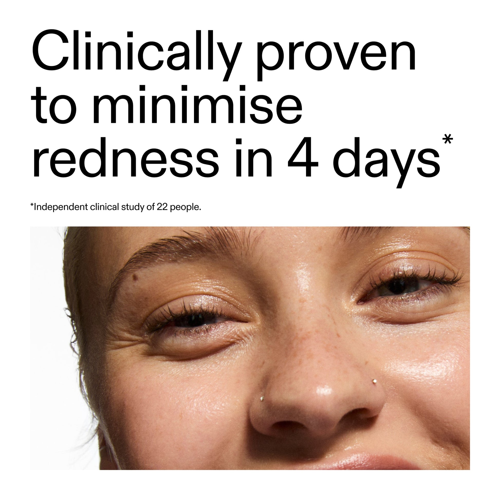 10-azelaic-acid-serum-for-redness-relief-w7 Oat_Cleansing_Balm_Claim_2000x2000_52a841dc-353c-4f2c-8646-3aadb604507d.jpg