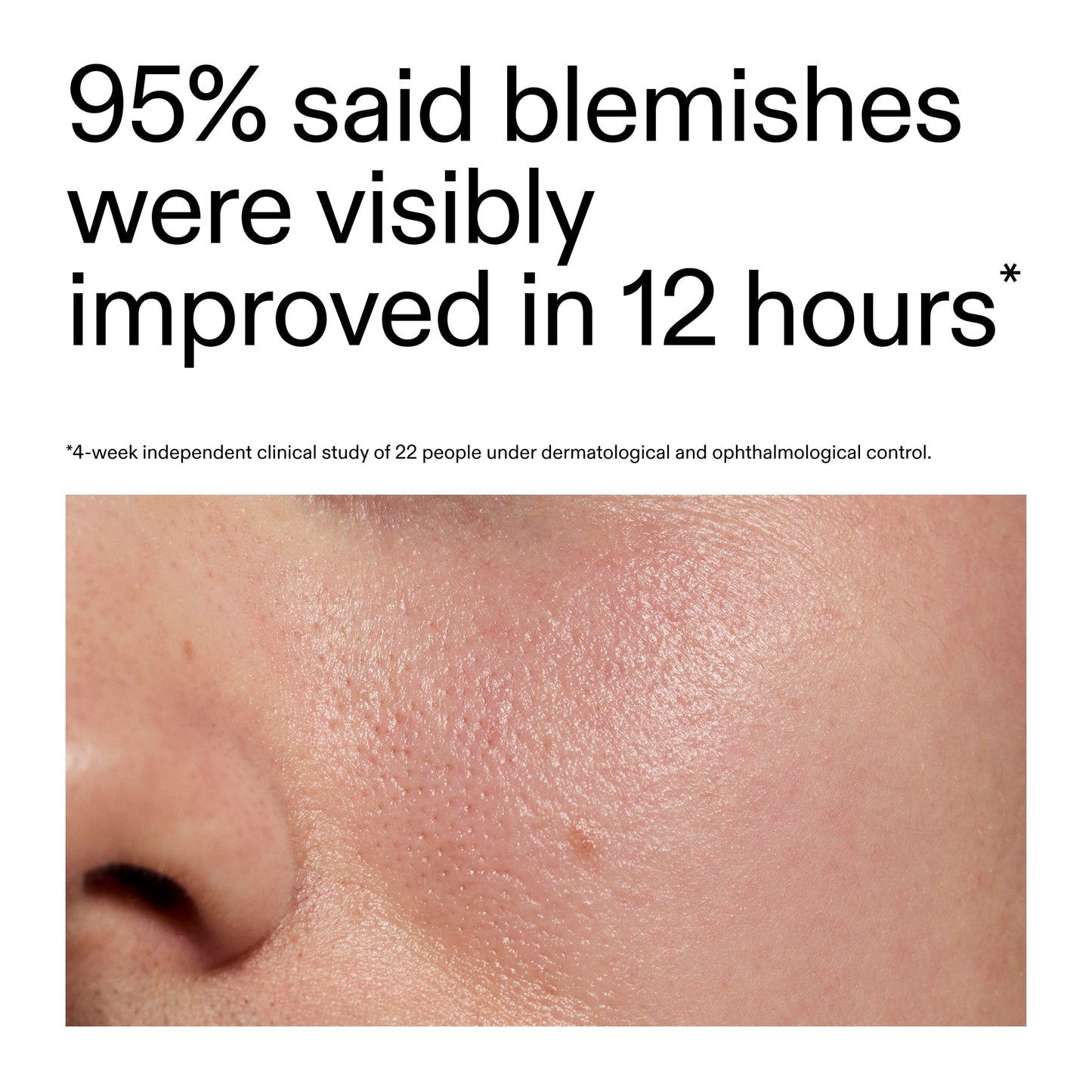 succinic-acid-acne-treatment-q6 Oat_Cleansing_Balm_Claim_2000x2000_ac6ce553-25db-41b2-a981-faae1ac4b8c0.jpg