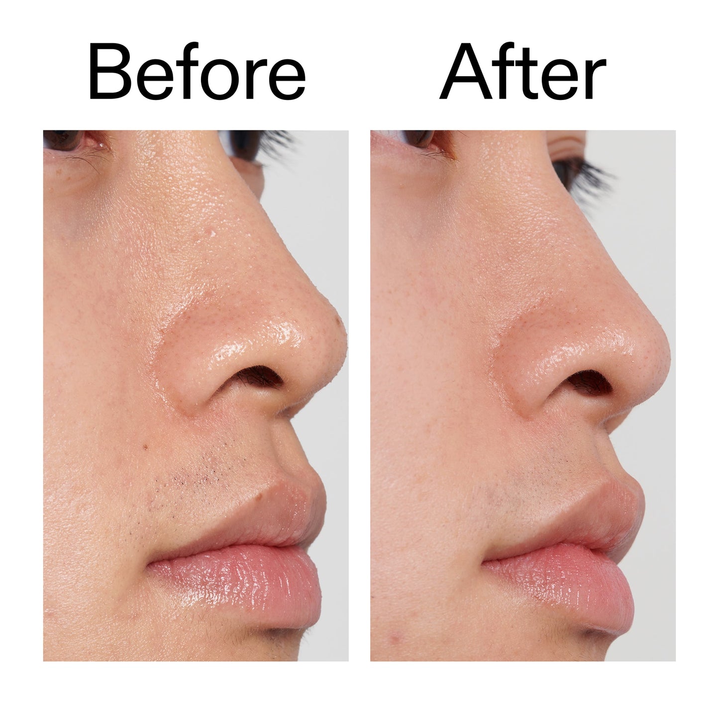 pha-toner-n1 PHA_Toner_Before_After_2000x2000_e3c10172-0150-4342-8b95-57417eaff50d.jpg