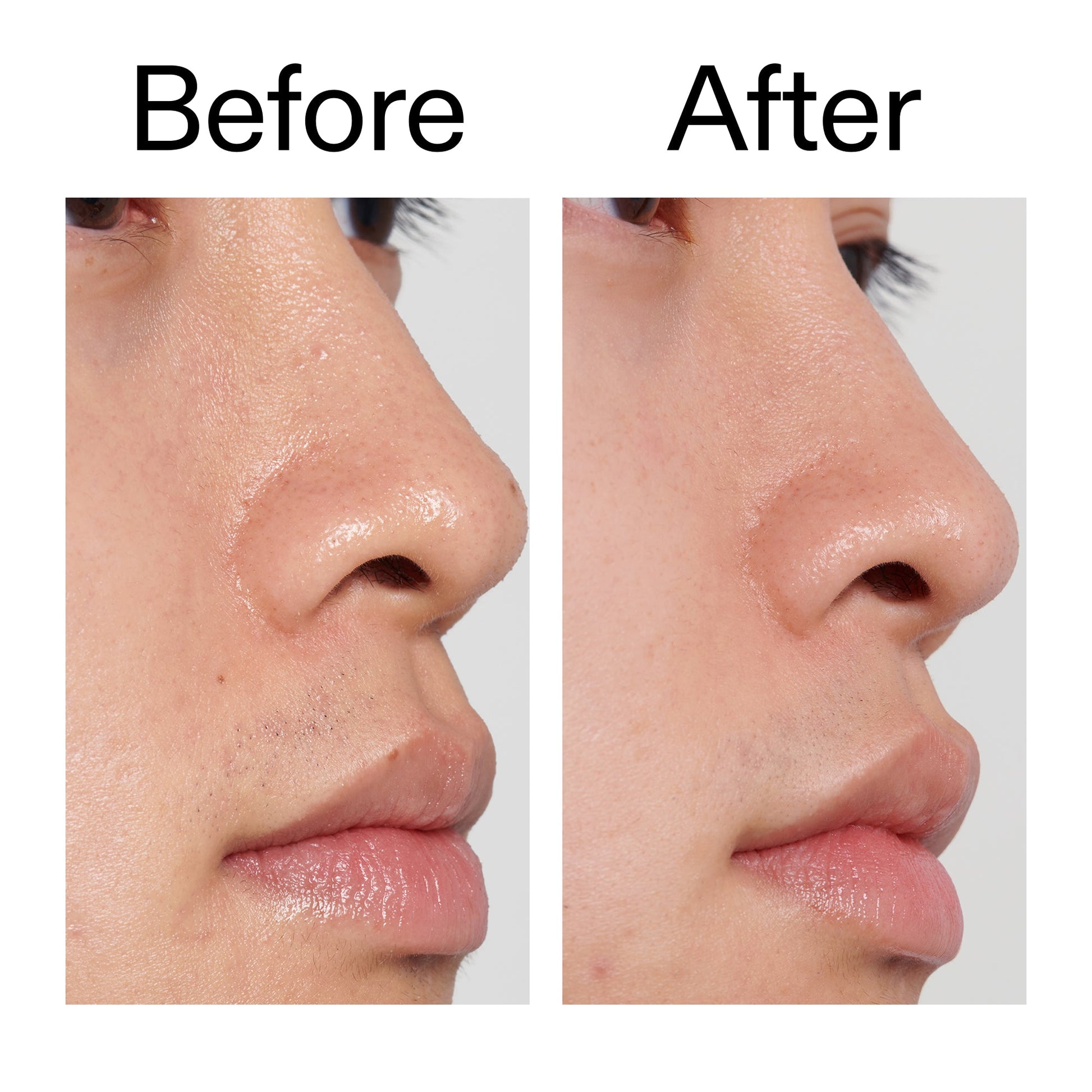 pha-toner-n1 PHA_Toner_Before_After_2000x2000_e3c10172-0150-4342-8b95-57417eaff50d.jpg