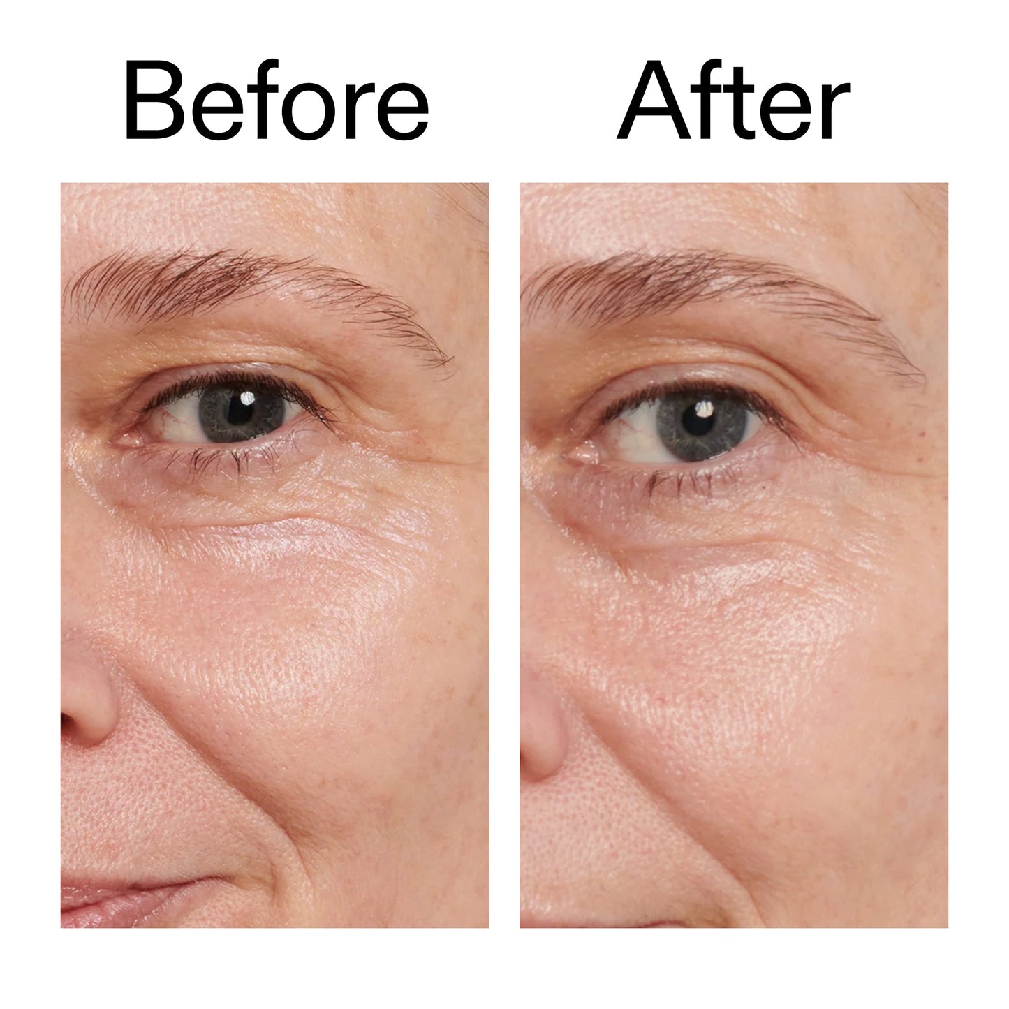 retinol-eye-cream-f8 Retinol_Eye_Cream_Before_After_2000x2000_ac03a80c-109e-4572-a95a-91dc109b4d27.jpg