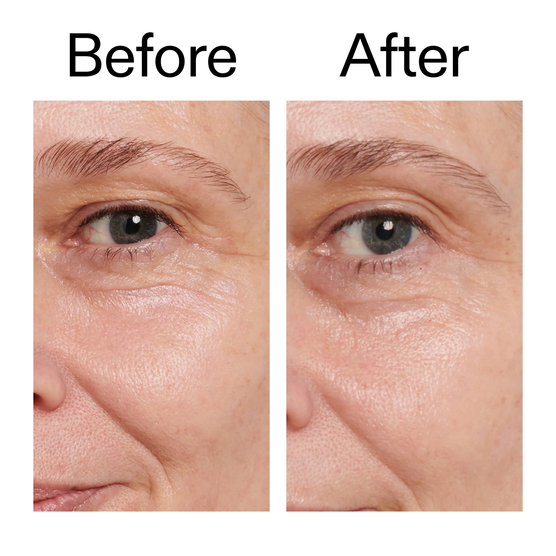 retinol-eye-cream-f8 Retinol_Eye_Cream_Before_After_2000x2000_ac03a80c-109e-4572-a95a-91dc109b4d27.jpg