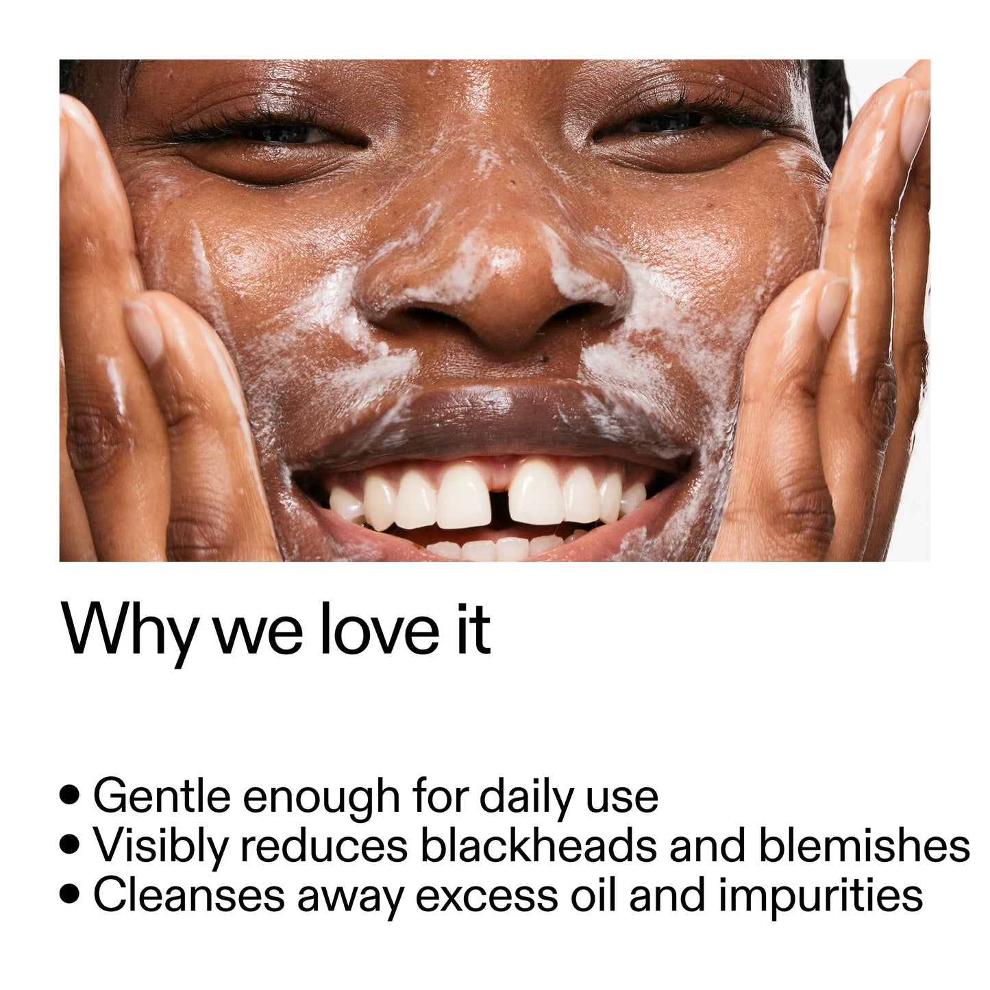 salicylic-acid-cleanser-150ml-j2 Salicylic_Acid_Cleanser_-_300mlWhy_we_love_it_2000x2000_87dc92a9-2559-4309-98cd-4e570f1be735.jpg