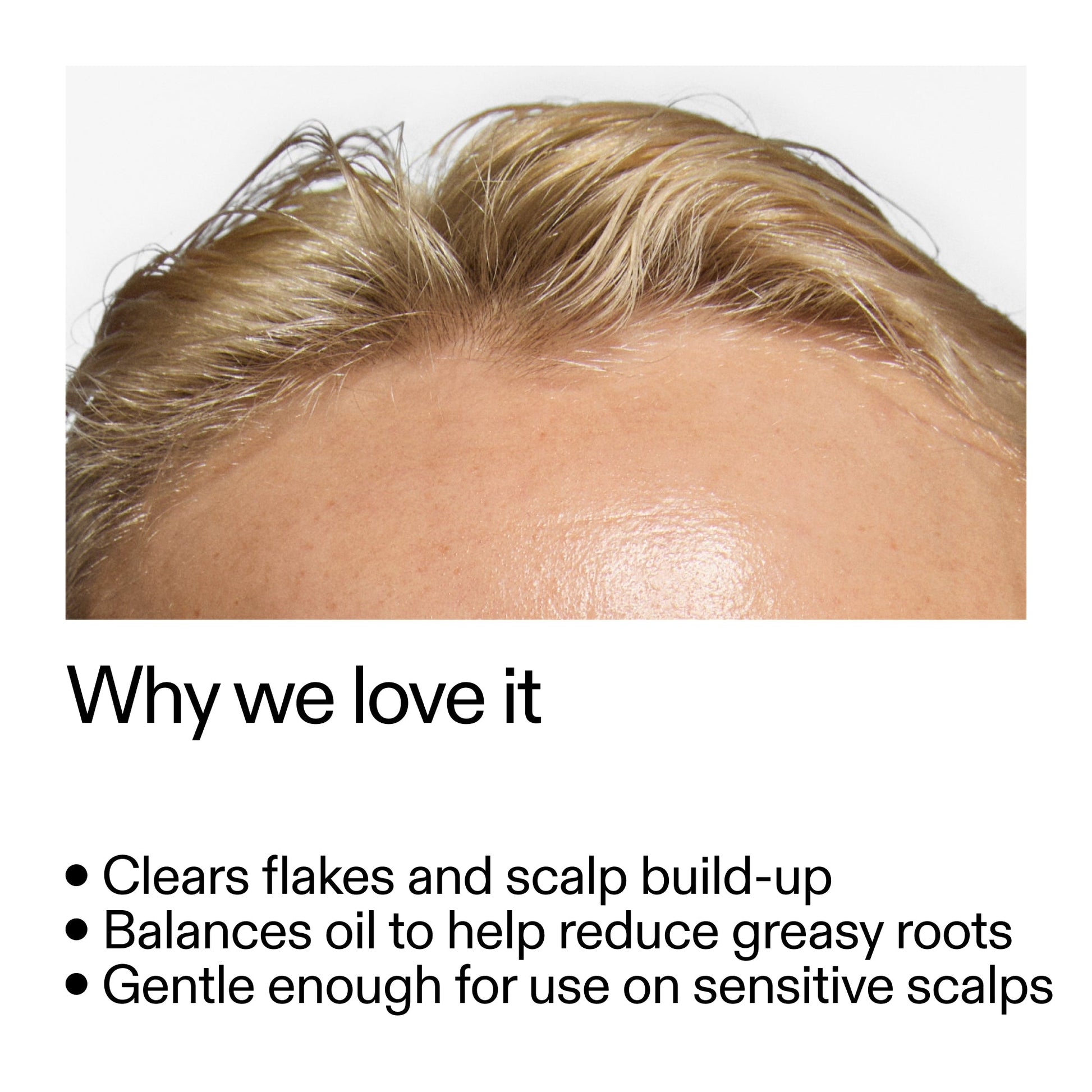 salicylic-acid-exfoliating-scalp-treatment-h7 Salicylic_Acid_Exfoliating_Scalp_Treatment_Why_we_love_it_2000x2000_44b6bd6d-9ec4-4b23-9dc4-bc3fd6f28e14.jpg