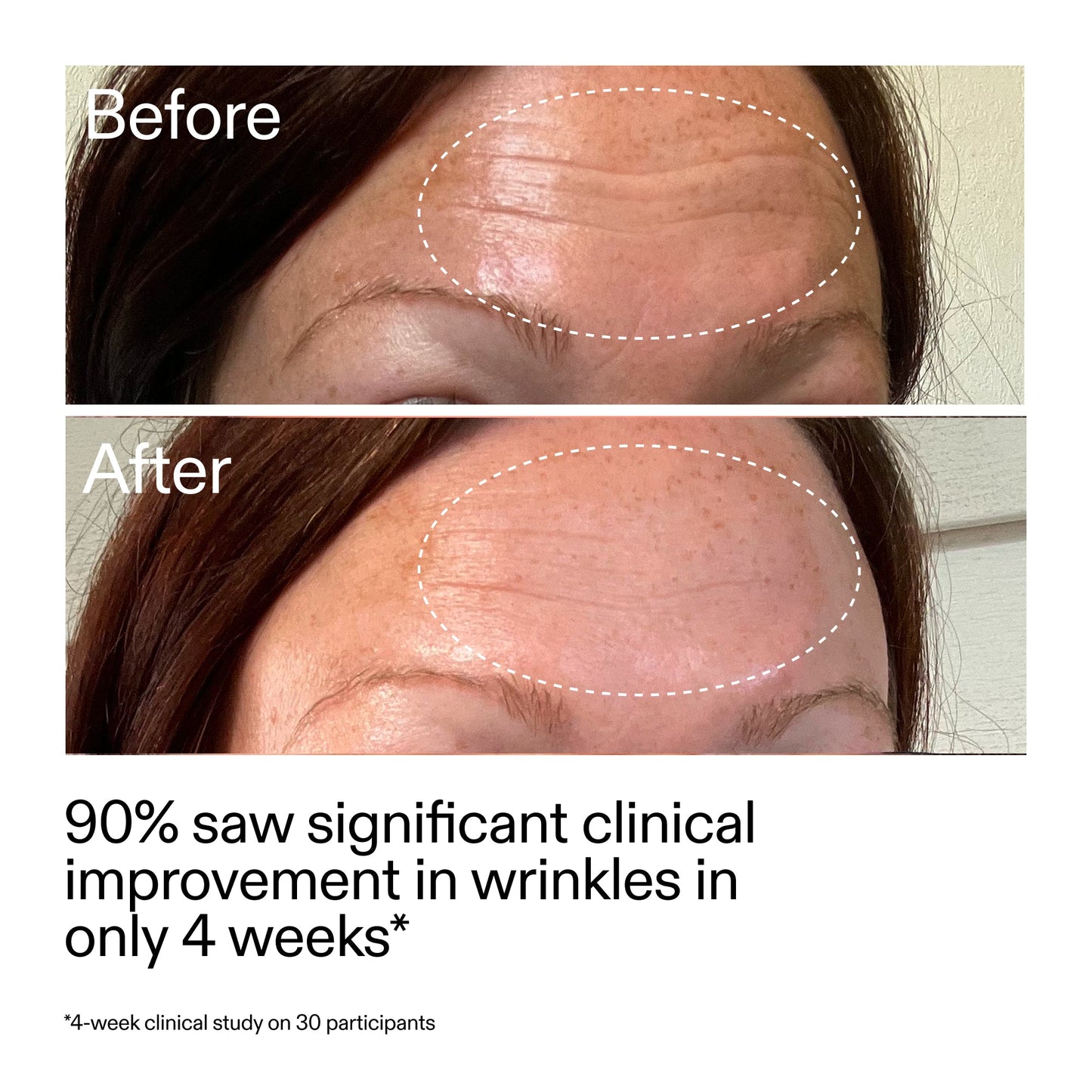 starter-retinol-serum-duo-i1 StarterRetinol_BeforeAfter_Claim1_2000x2000_03b4d6e5-a357-43b9-a855-aba5e35c57f3.jpg