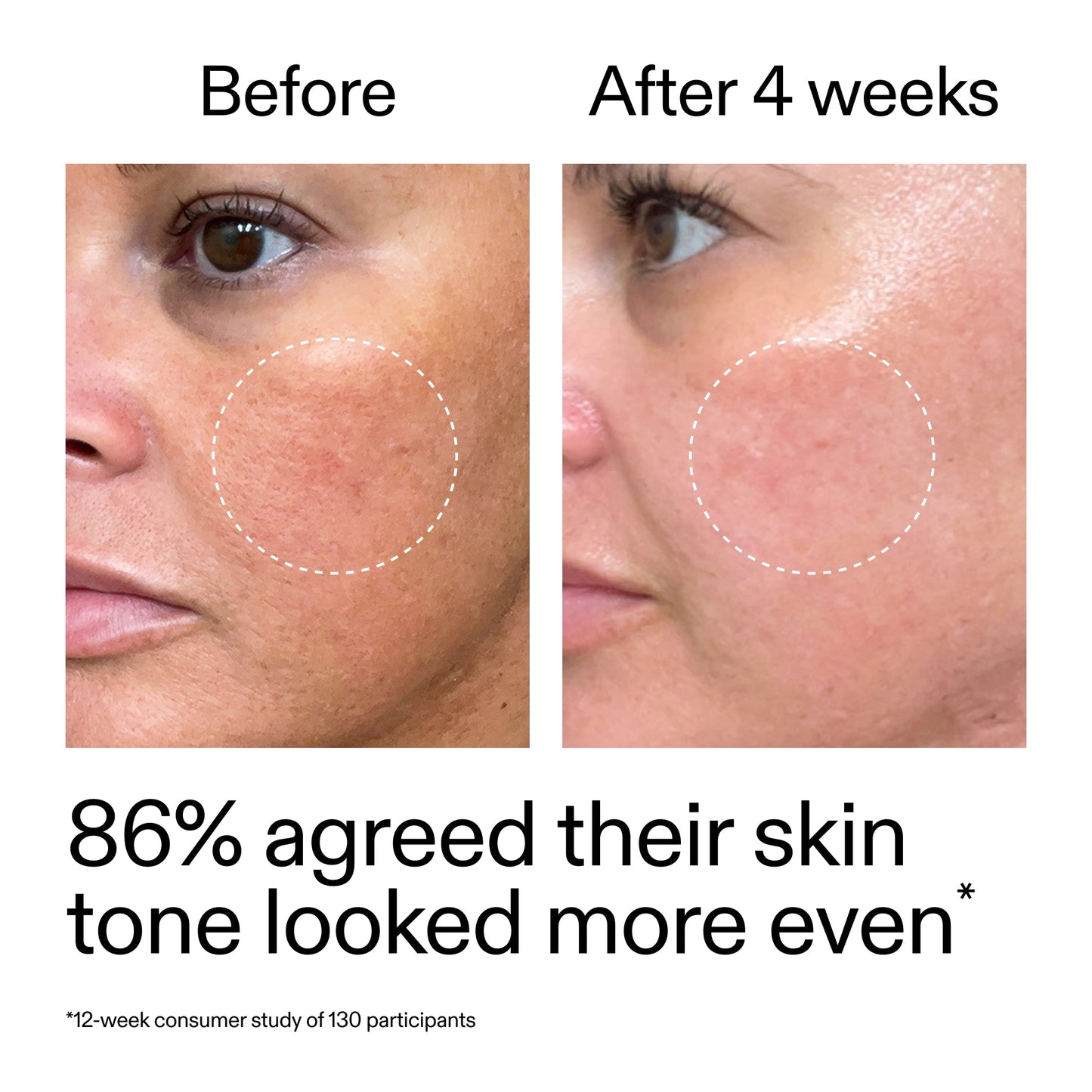 starter-retinol-serum-duo-i1 StarterRetinol_BeforeAfter_Claim2_2000x2000_fc5bb8ac-8588-478f-98d5-28af6651601a.jpg