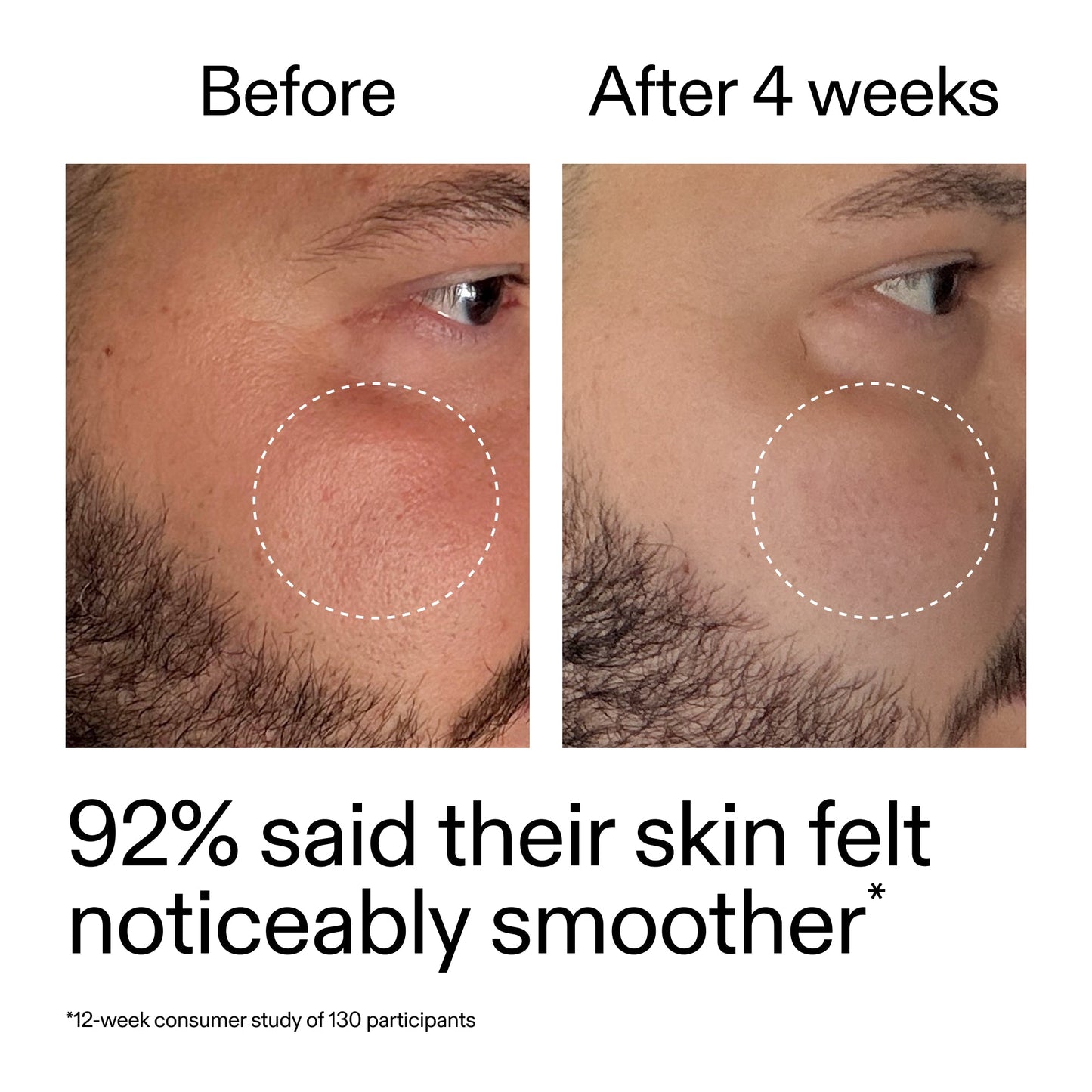 starter-retinol-serum-x3 StarterRetinol_BeforeAfter_Claim3_2000x2000_6ceab106-e0ee-4ed4-ba62-41bc39538038.jpg