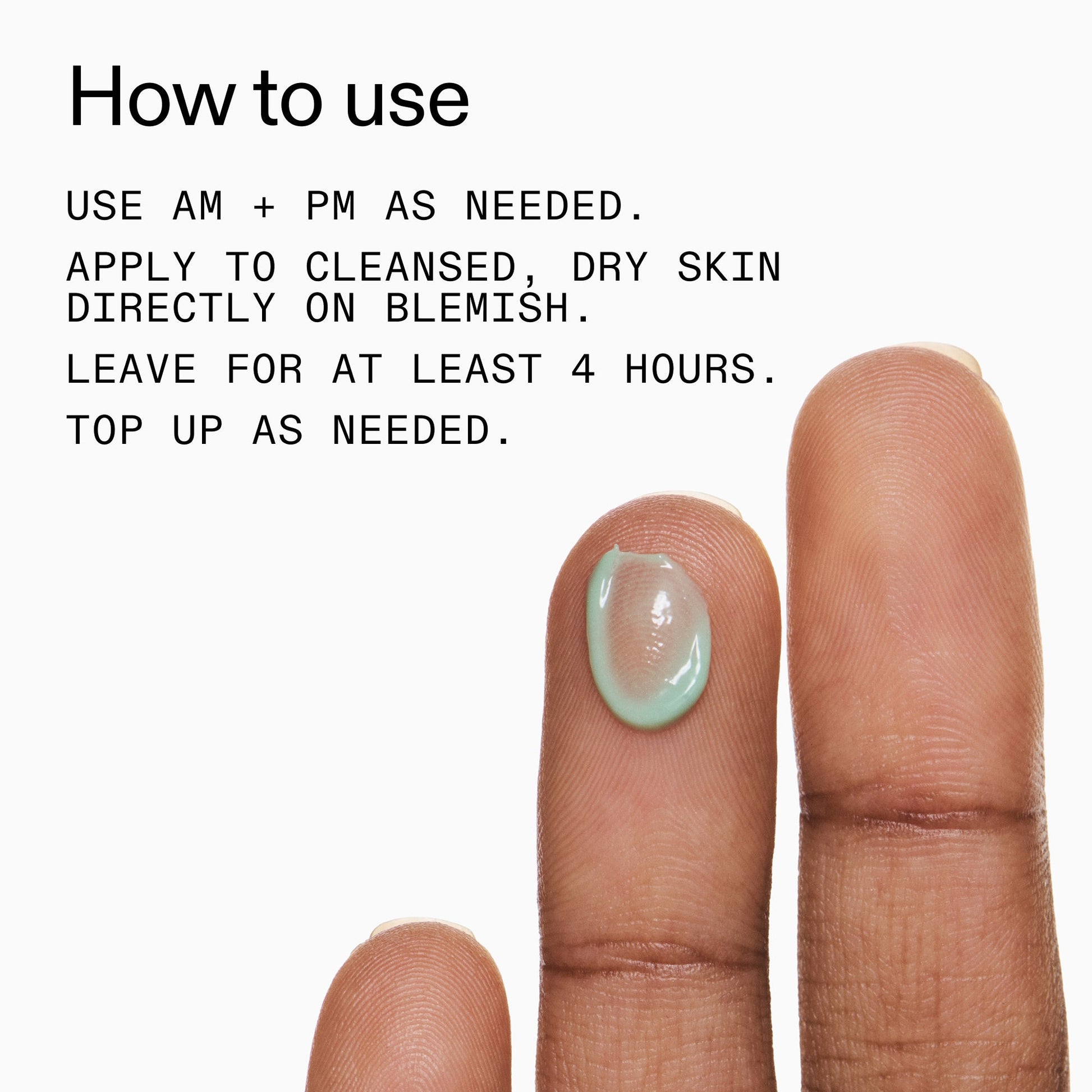 succinic-acid-acne-treatment-q6 Succinic_Acid_Treatment_How_to_Use_2000x2000_d57137d5-d7f1-427c-9a46-5fc00c19c542.jpg