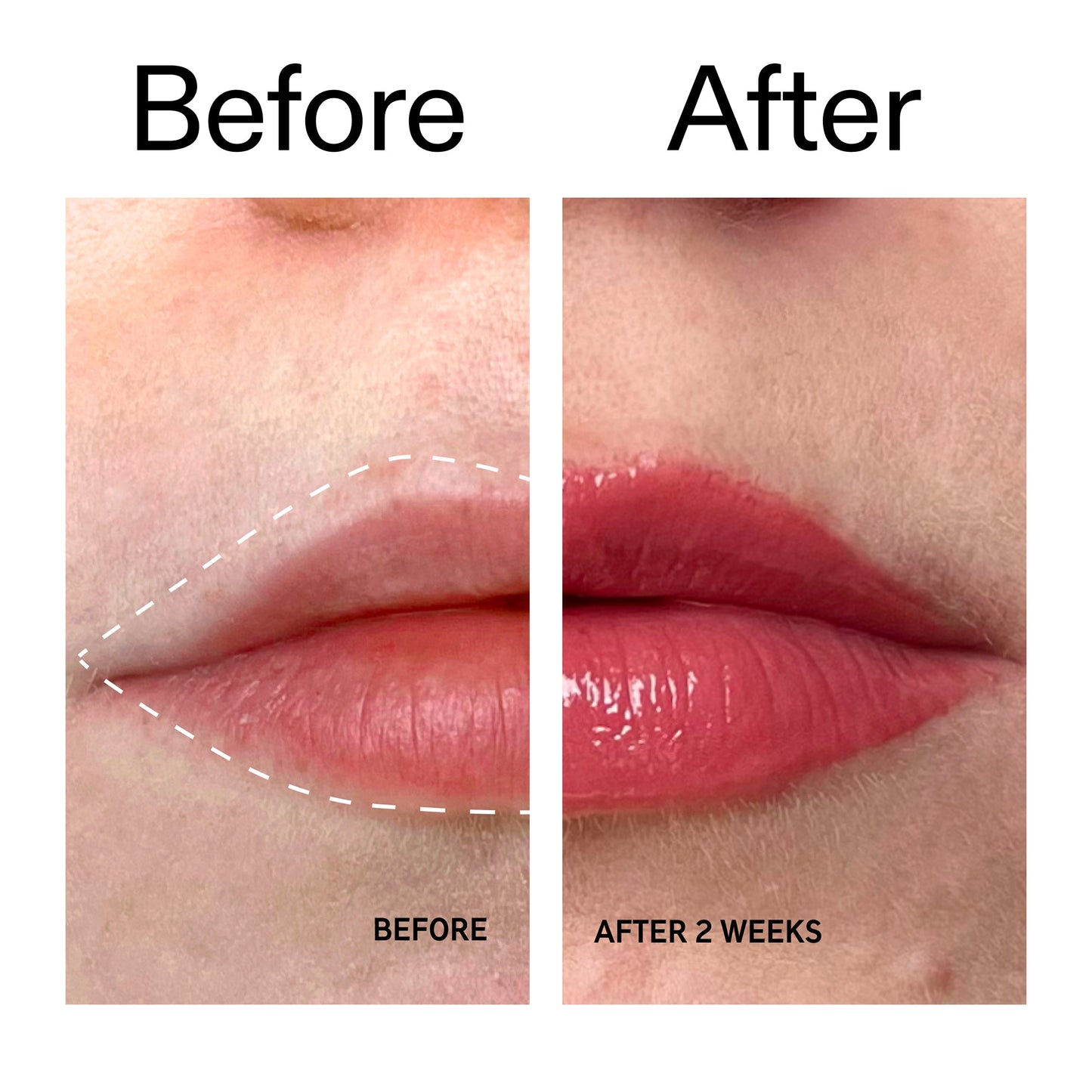 tripeptide-plumping-berry-lip-balm-v3 Tripeptide_Plumping_Lip_Balm_-_Berry_Before_After_2000x2000_9474bbd8-43ca-4b0e-b0e7-dfab70b91927.jpg