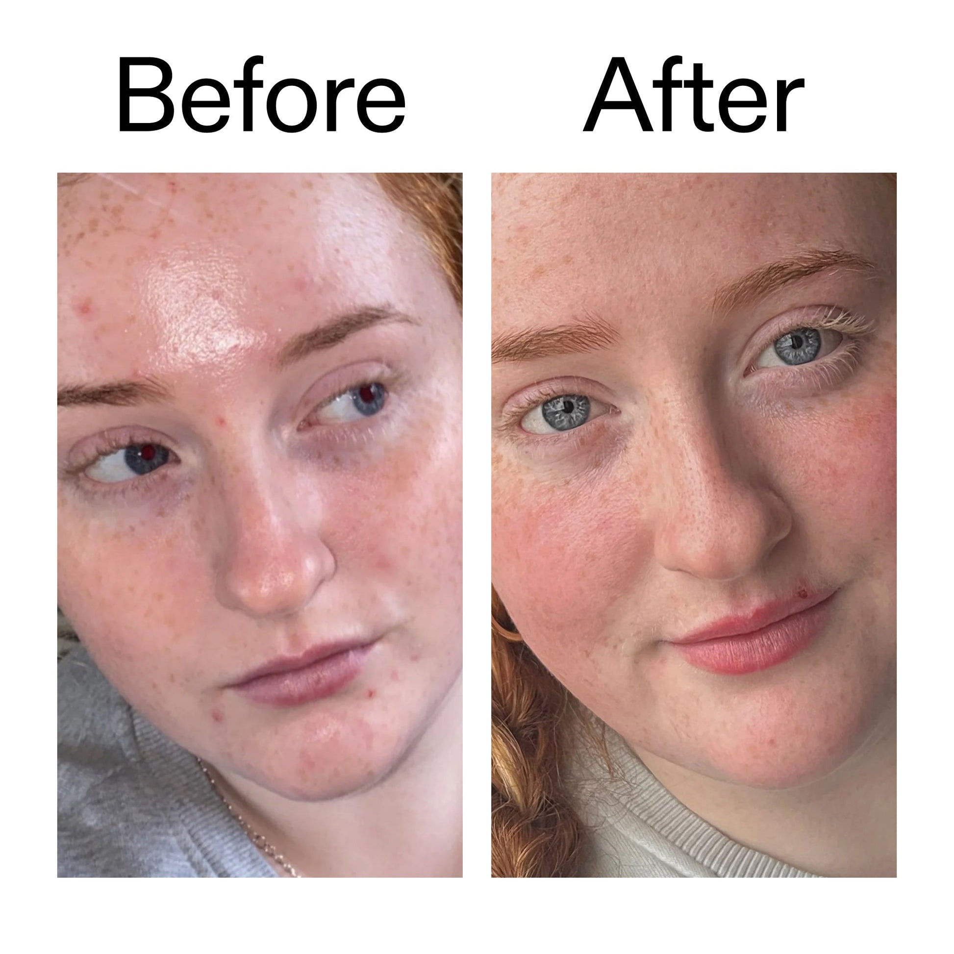 vitamin-b-c-and-e-moisturizer-w4 Vitamin_B_C_and_E_Moisturizer_Before_After_2000x2000_b0781a76-5ad2-4be9-95b8-ef92b356833c.jpg